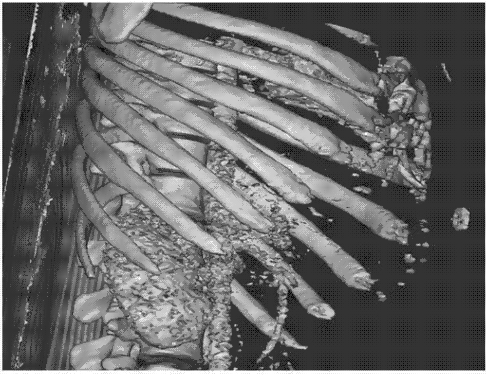 Liver tissue biopsy localization method under mimics three-dimensional reconstruction guidance for abdominal CT (computed tomography)