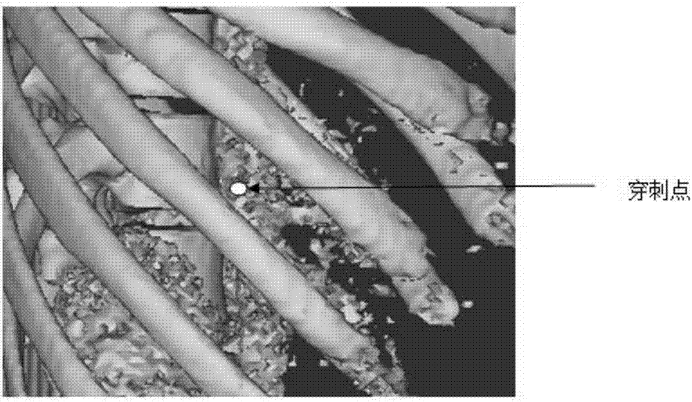 Liver tissue biopsy localization method under mimics three-dimensional reconstruction guidance for abdominal CT (computed tomography)