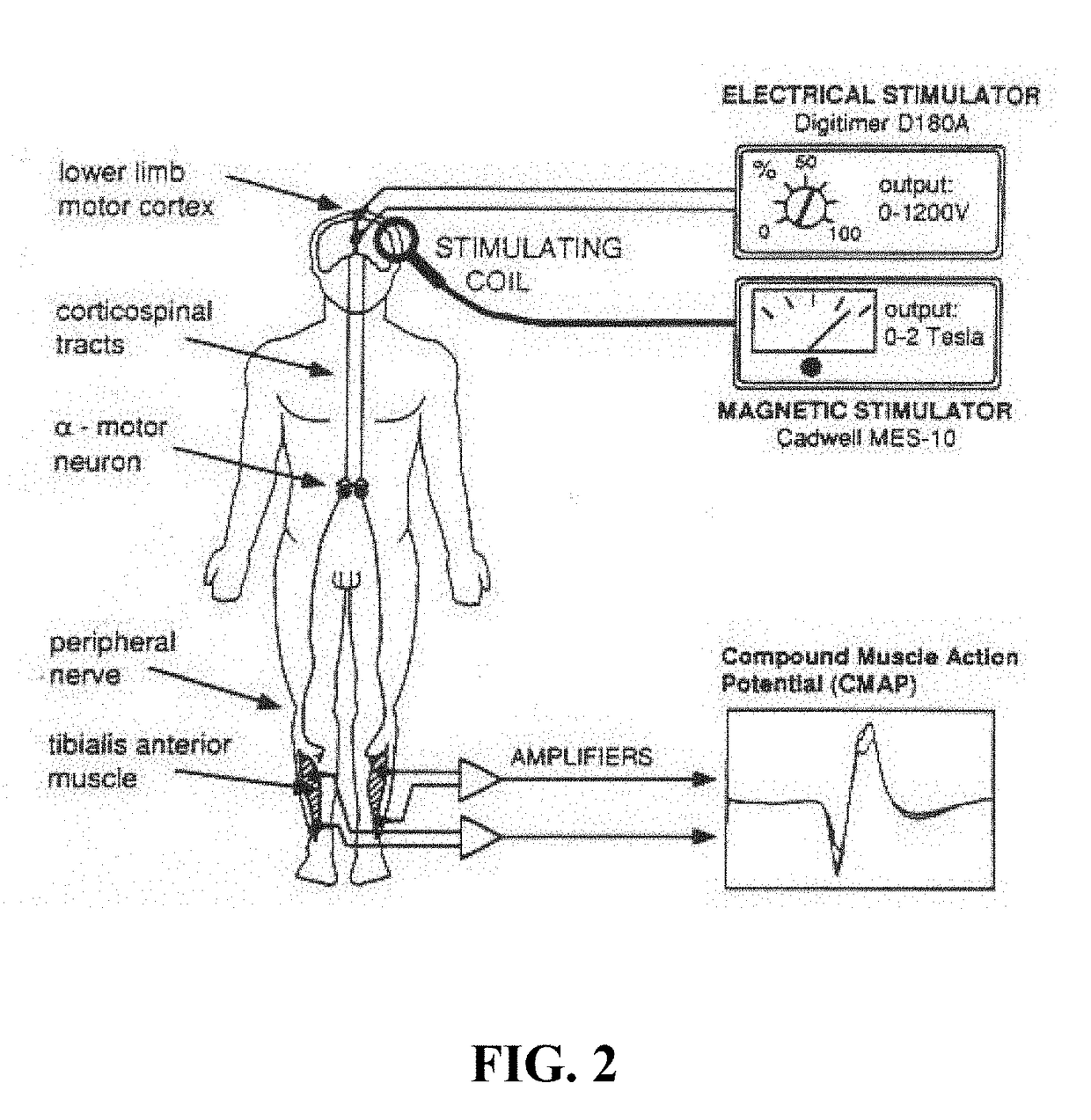 Skull implanted magnet assembly for brain stimulation