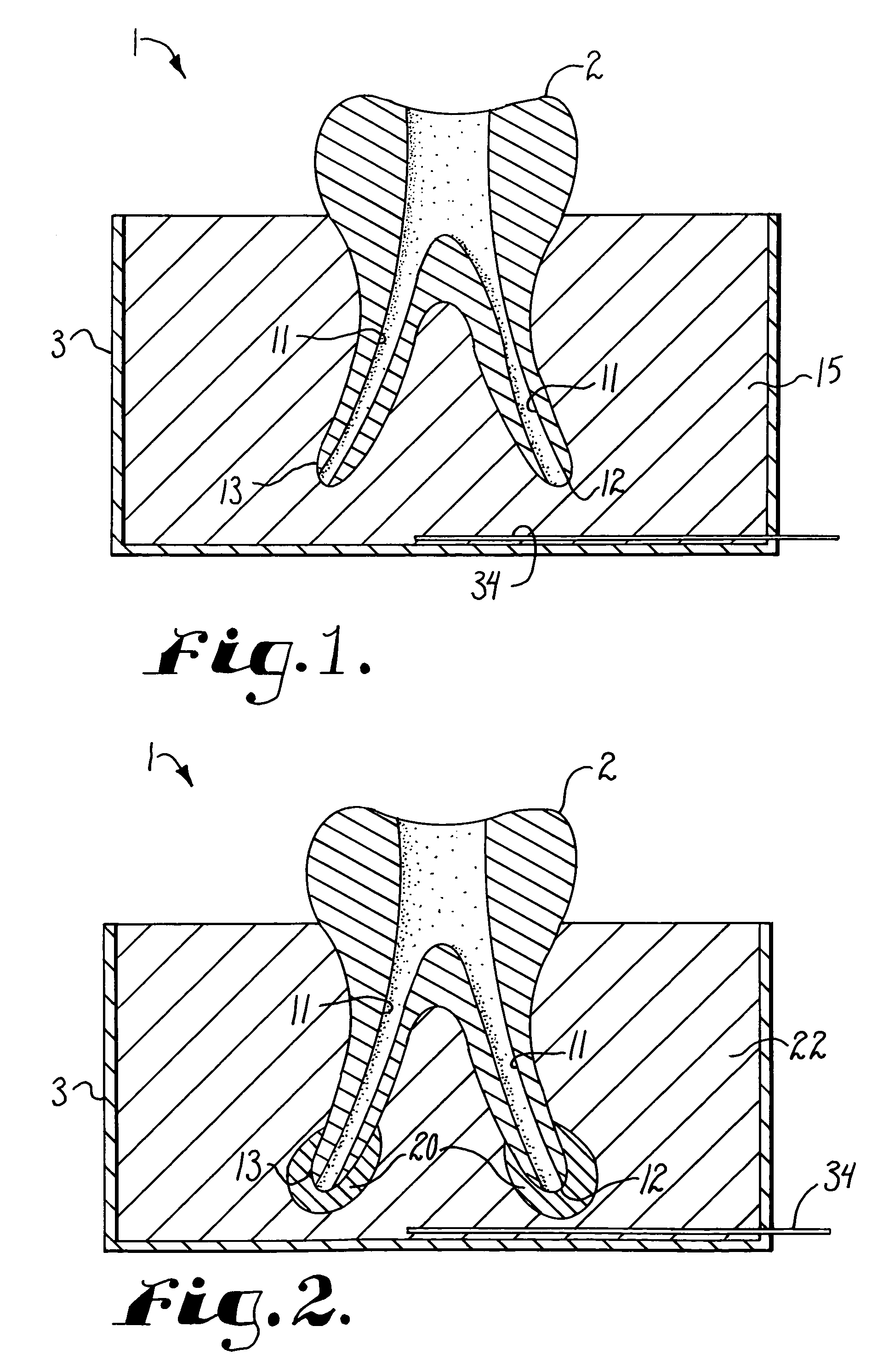 Dental training device