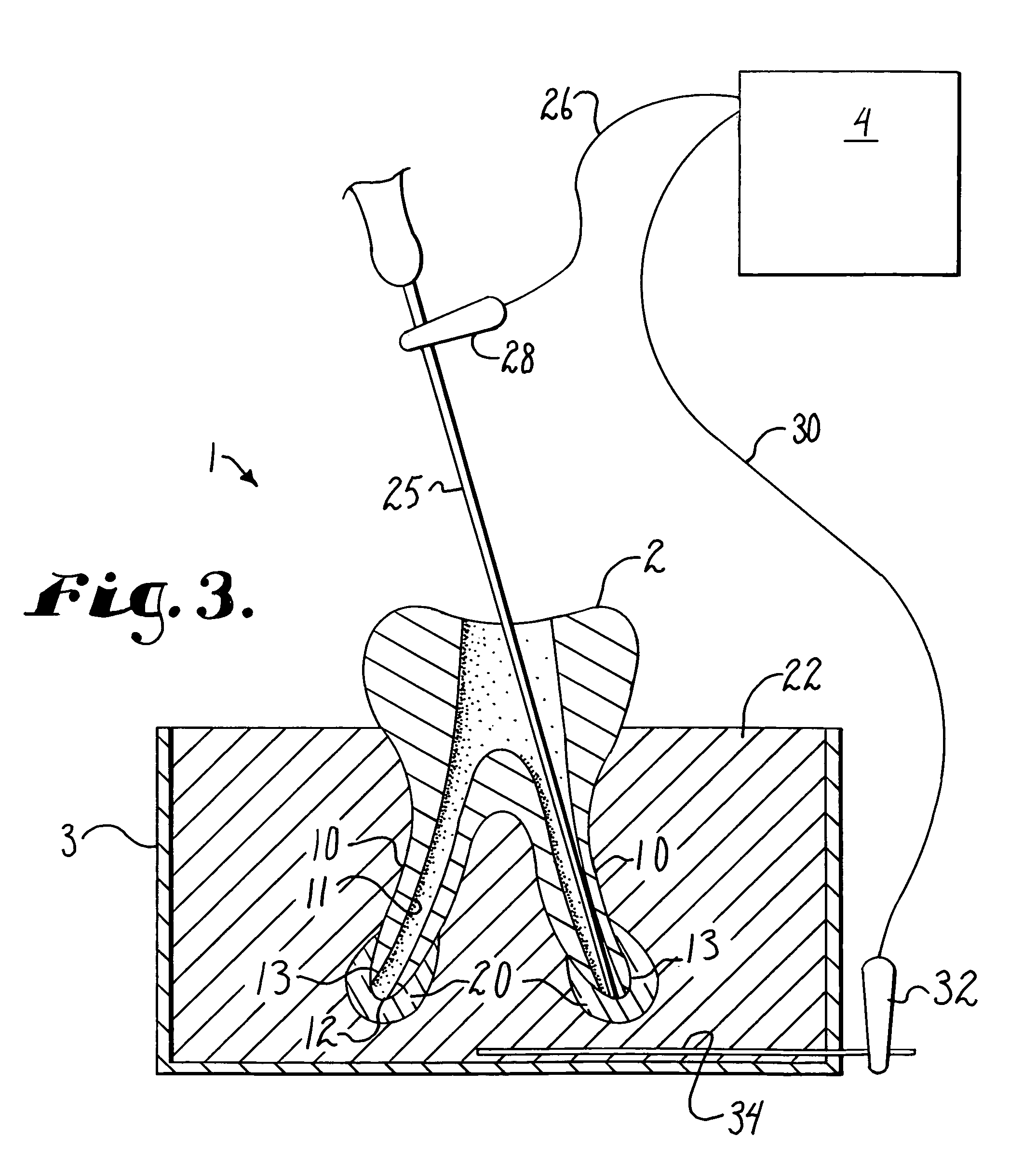 Dental training device