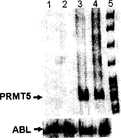 Application of protein arginine methyl transferase 5 in cell detection and treatment of leukemia