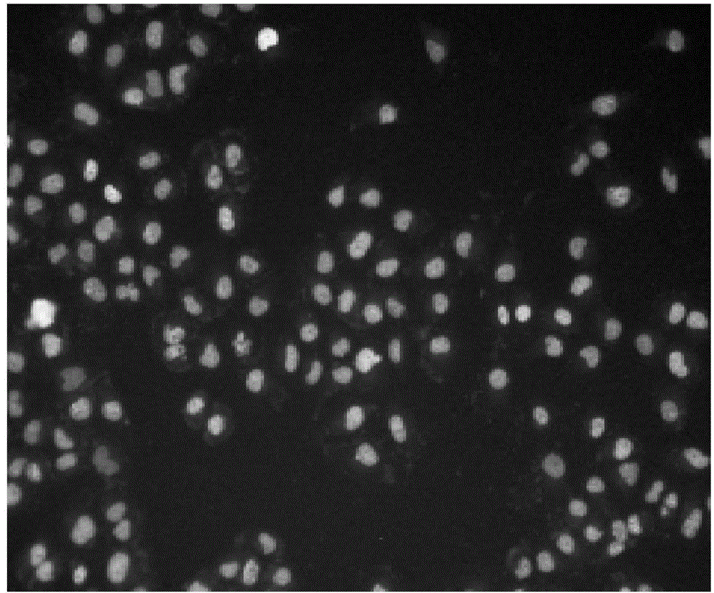 Novel use of 24-acetyl alisol F