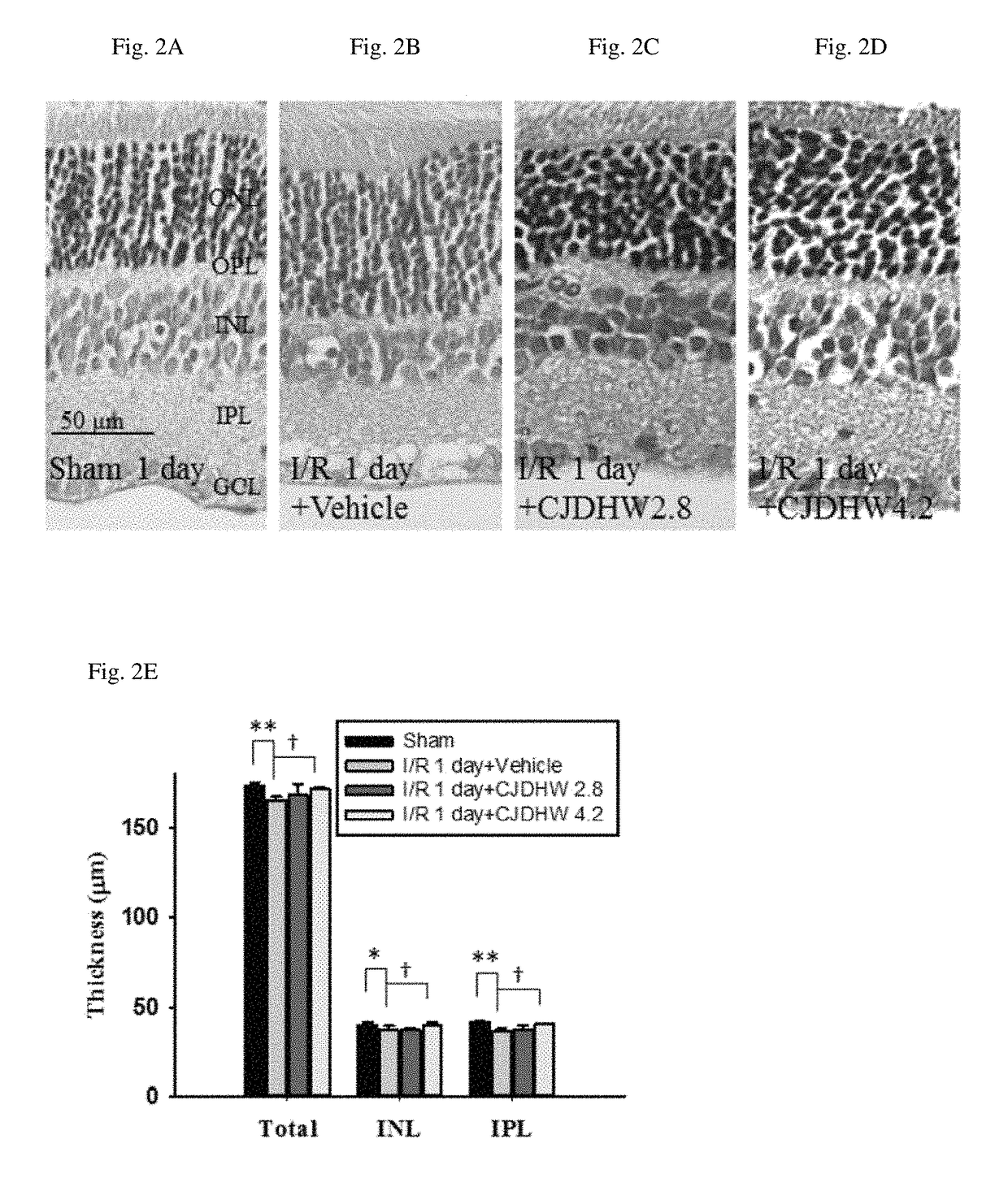 Use of chi-ju-di-huang-wan in treating retinal ischemia or a disease, condition, or disorder associated with retinal ischemia