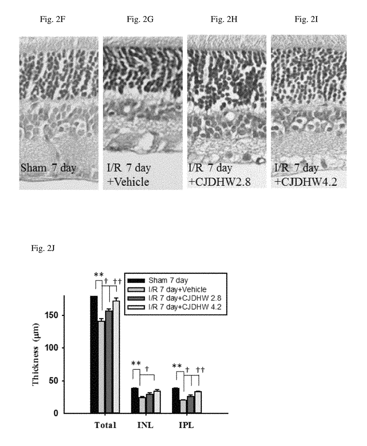 Use of chi-ju-di-huang-wan in treating retinal ischemia or a disease, condition, or disorder associated with retinal ischemia