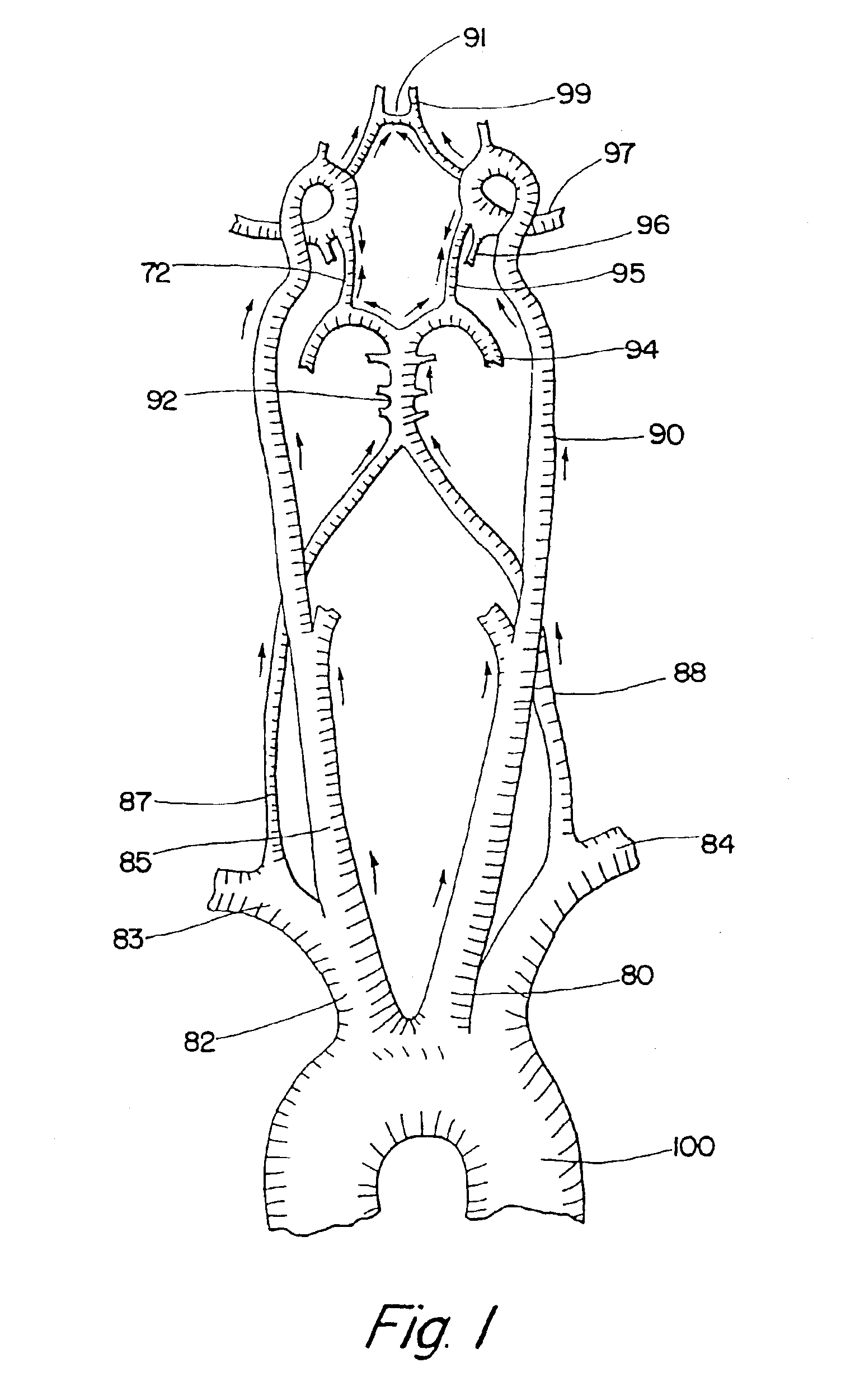 Methods for flow augmentation in patients with occlusive cerebrovascular disease