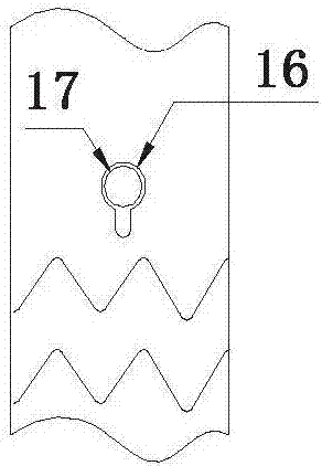 An intraoperative stent system