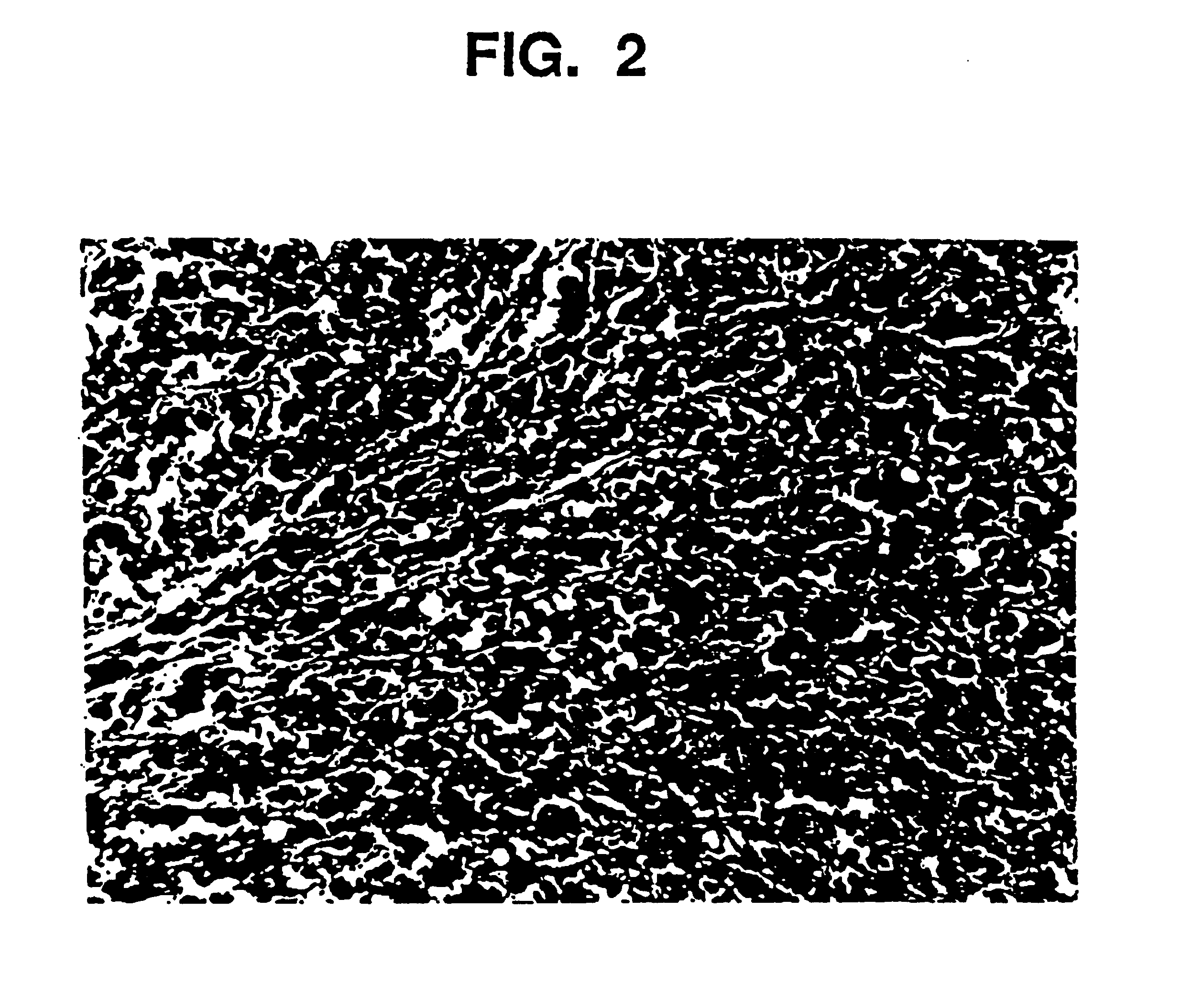 Tissue augmentation material and method