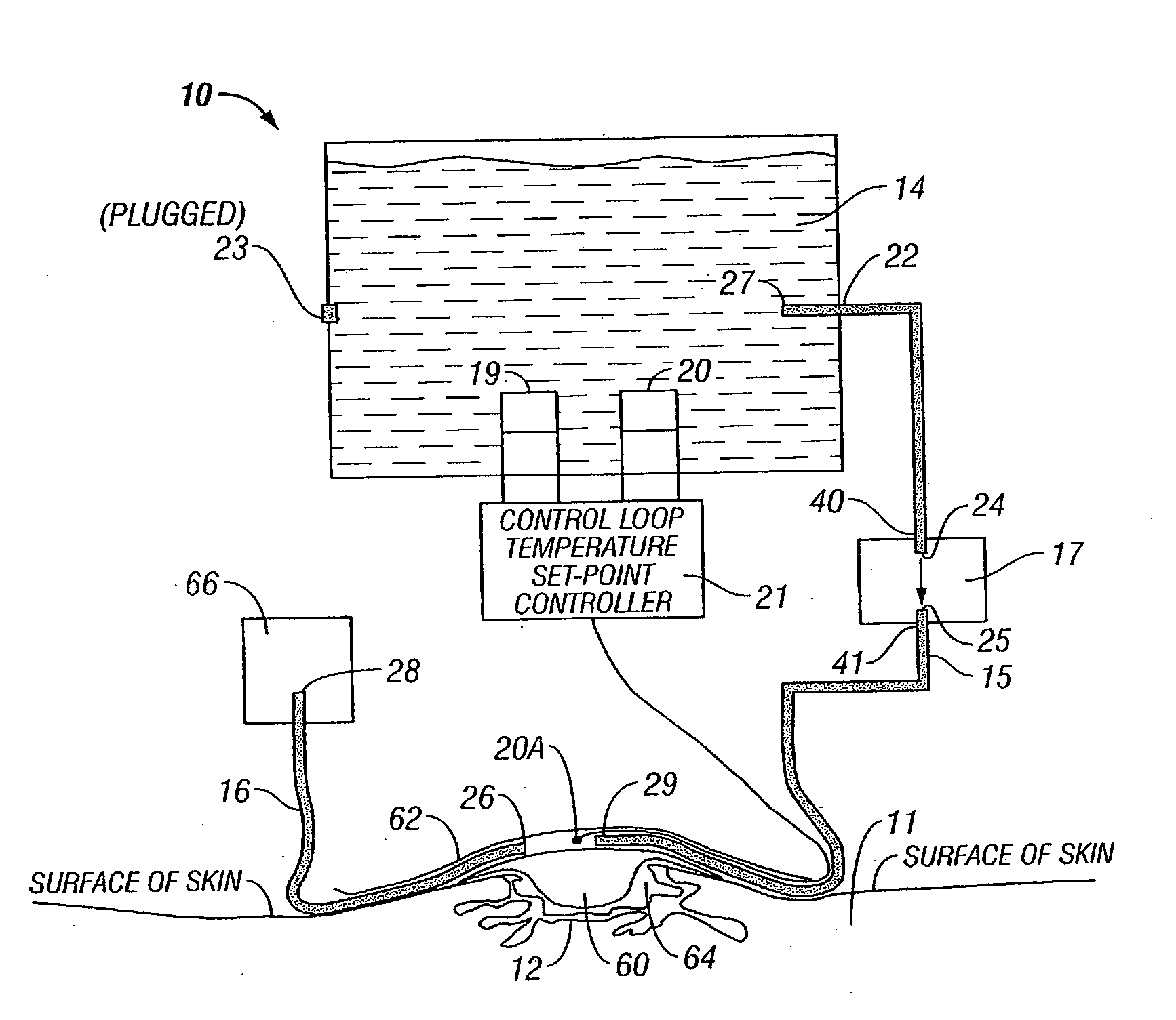 Localized liquid therapy and thermotherapy device