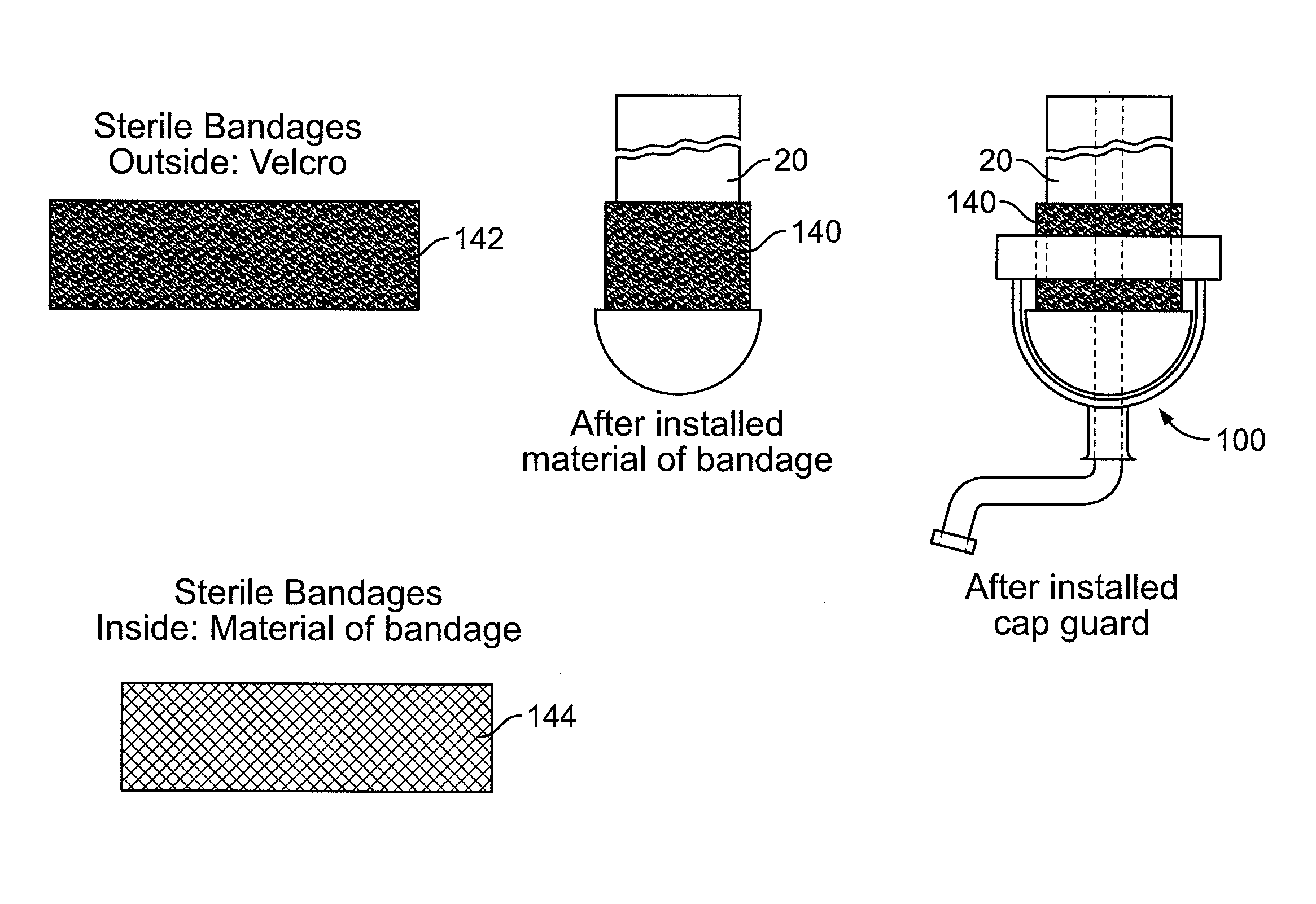 Catheter Cap Guard: A Catheter Accessory