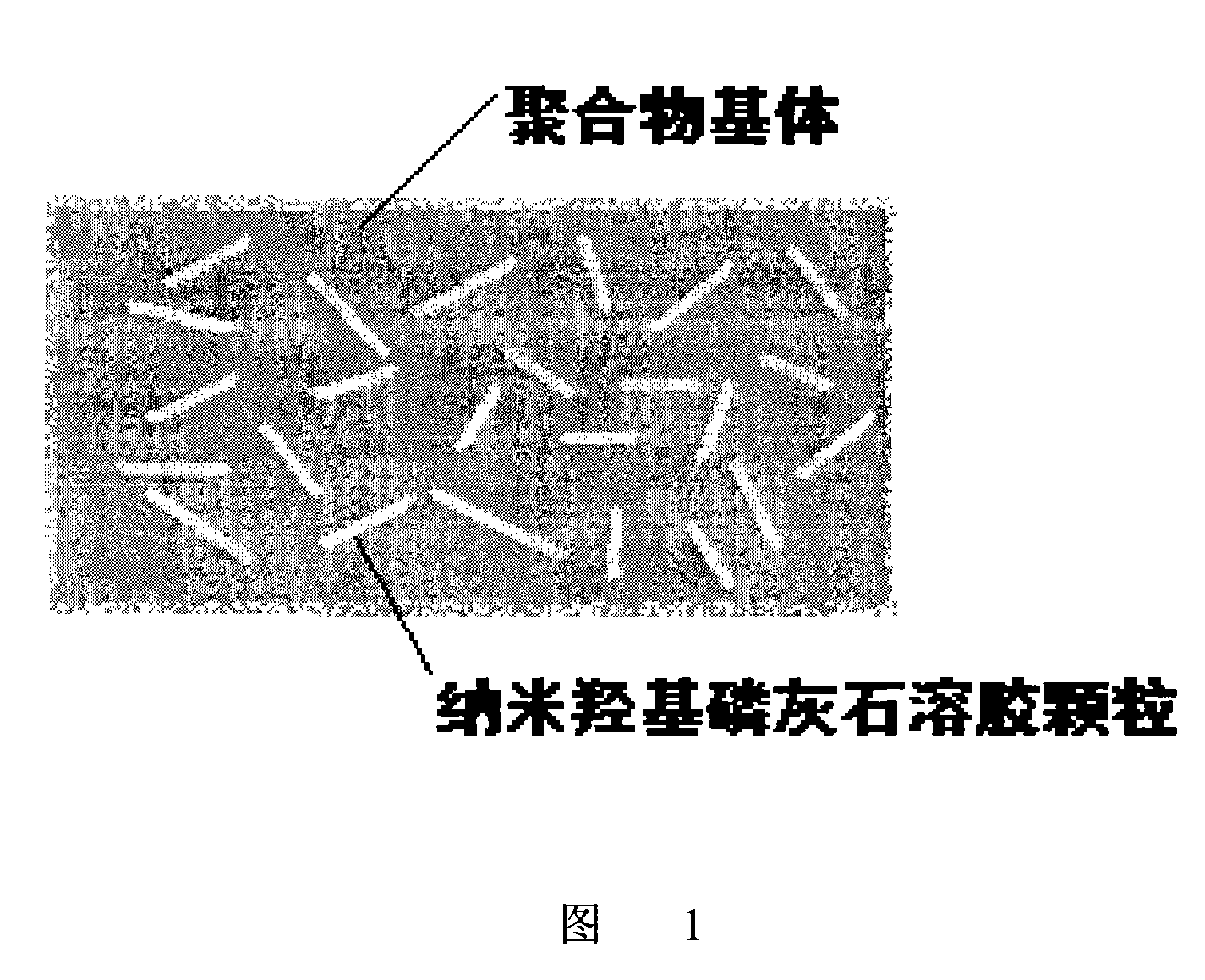 Method for preparing nano hydroxyapatite/polymer composite bone substitution material