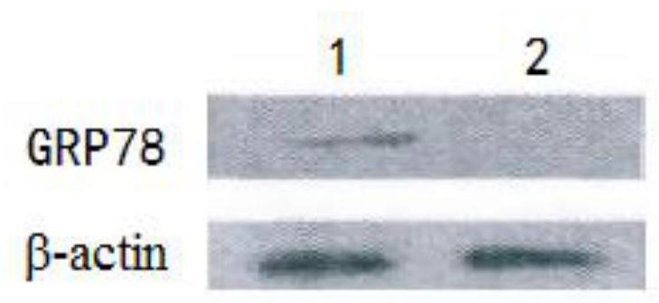 Cationic polypeptide-heat shock protein-miRNA gene compound as well as preparation method and application thereof