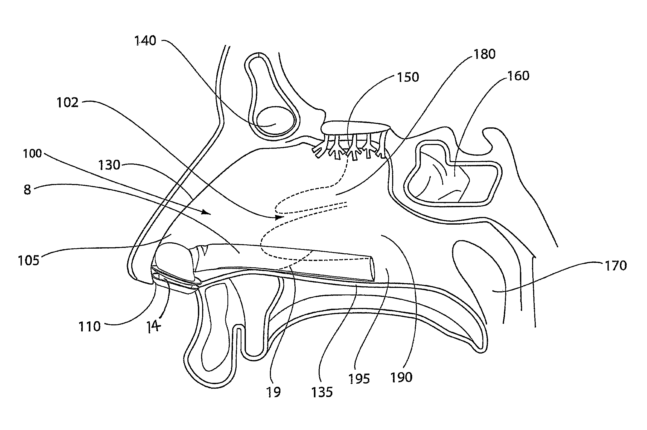 Nasal inserts