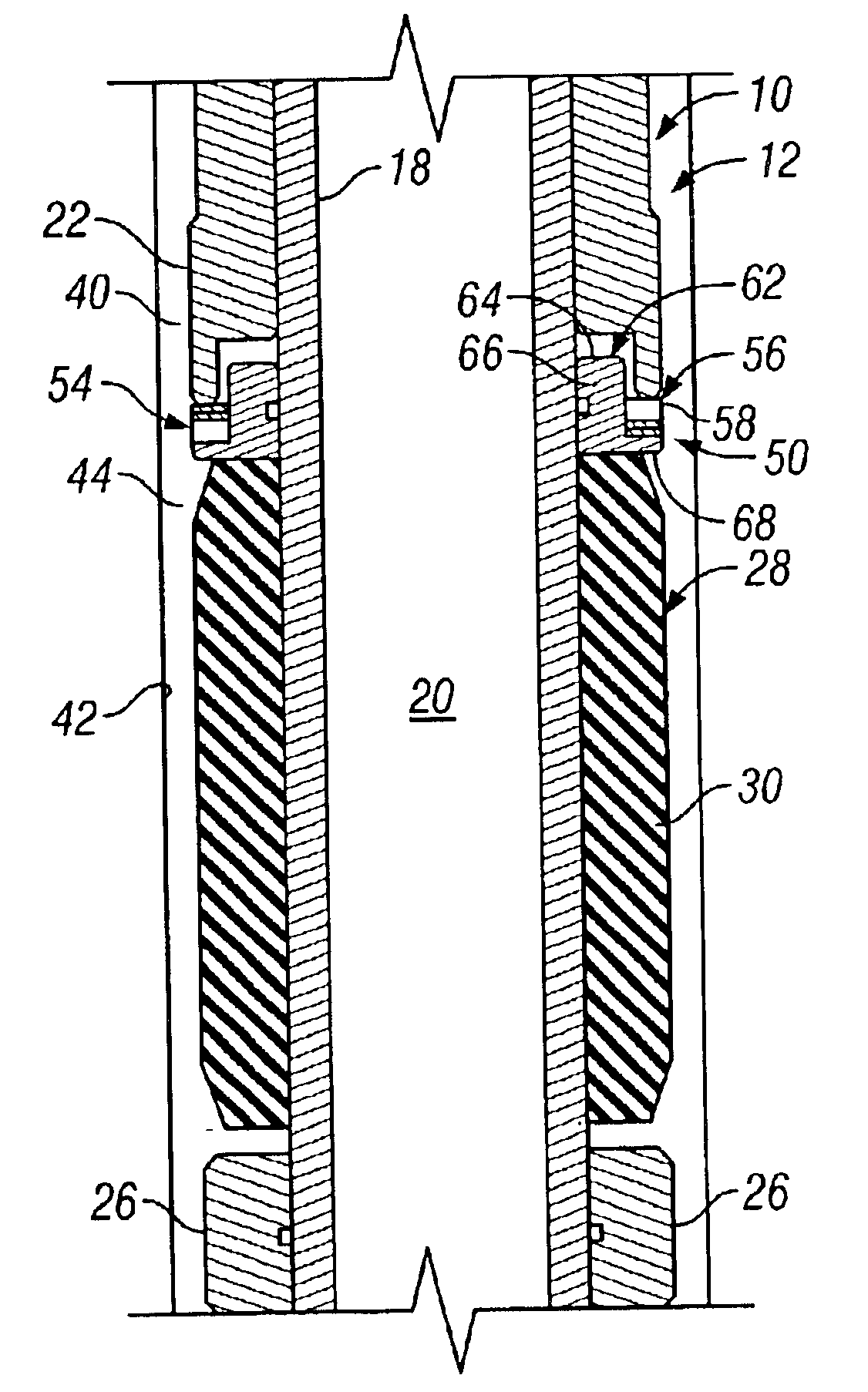 Anti-extrusion apparatus and method