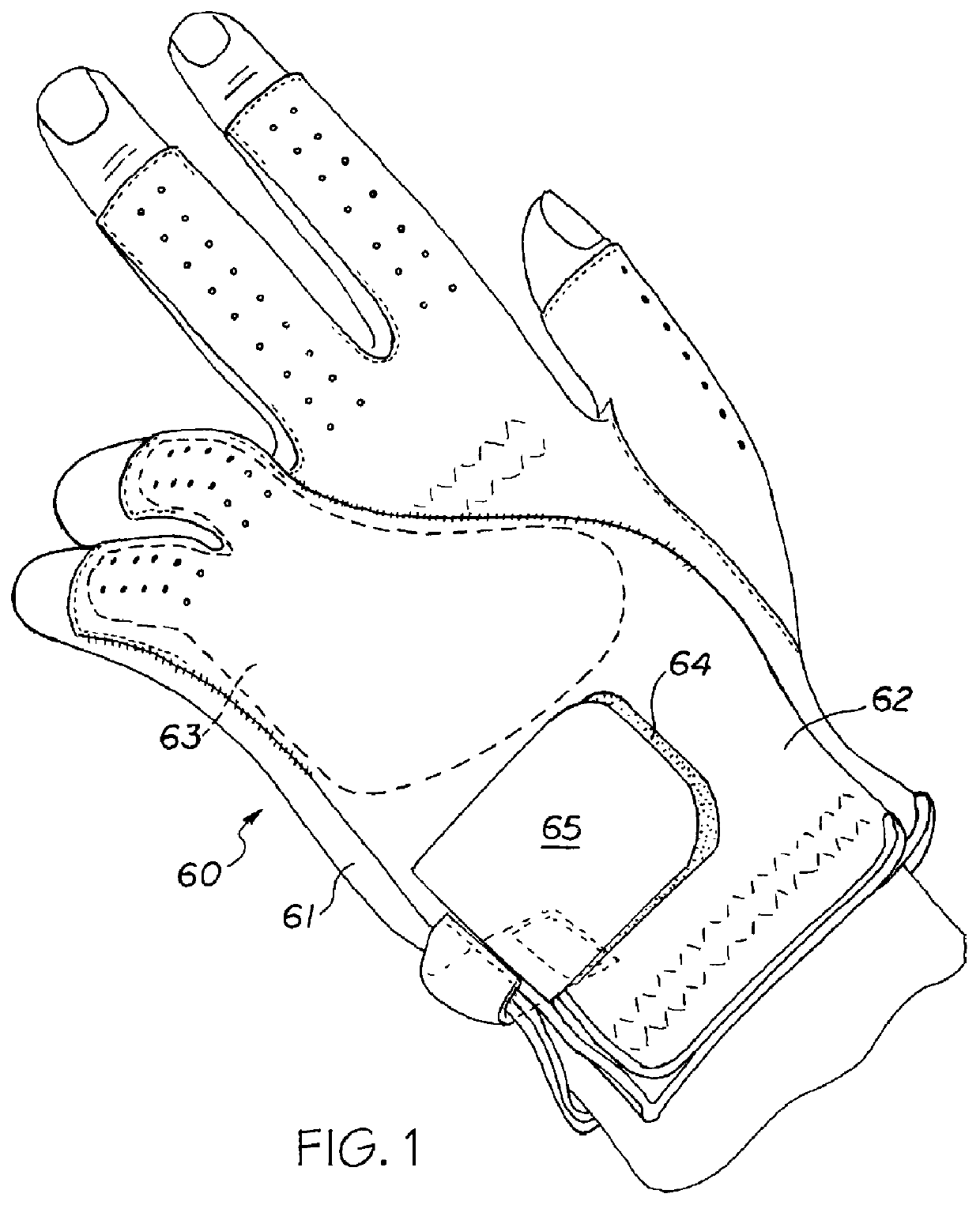 Remedial hand wear article for preventing hyperextension with full distal knuckle flexure