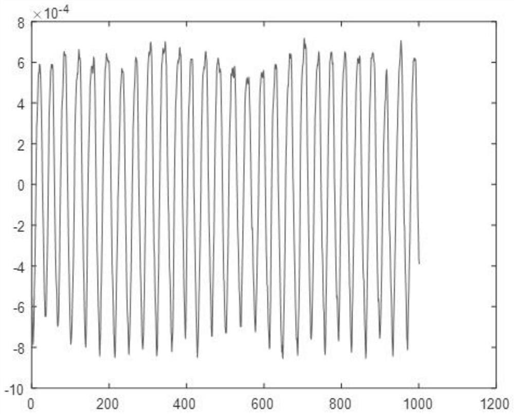 Method for extracting breathing state based on radar signal