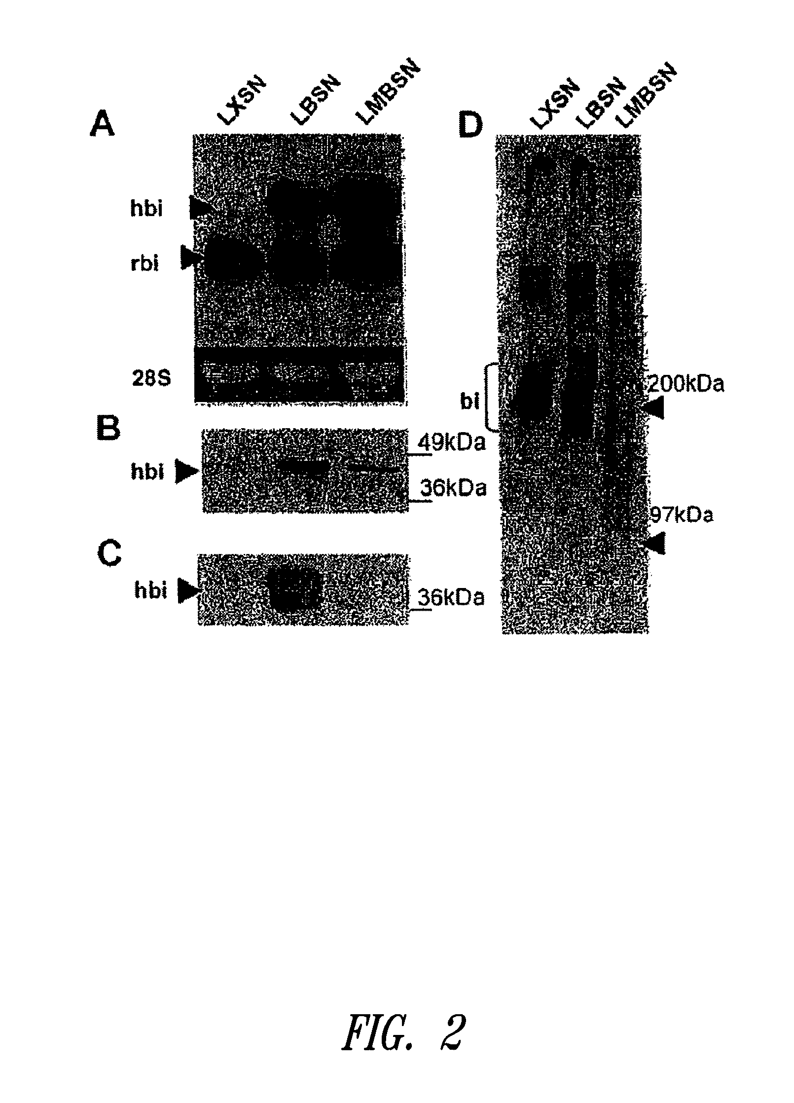 Methods for promoting elastogenesis and elastin fiber formation by increasing tropoelastin expression