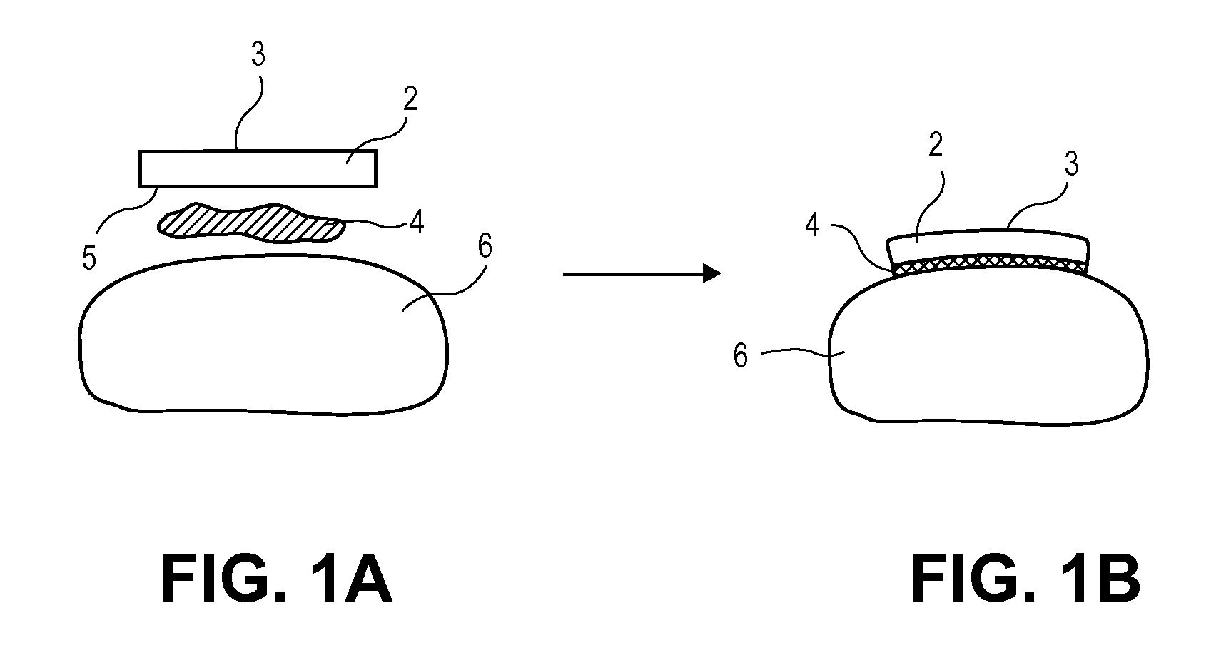 Methods, Devices and Compositions for Adhering Hydrated Polymer Implants to Bone