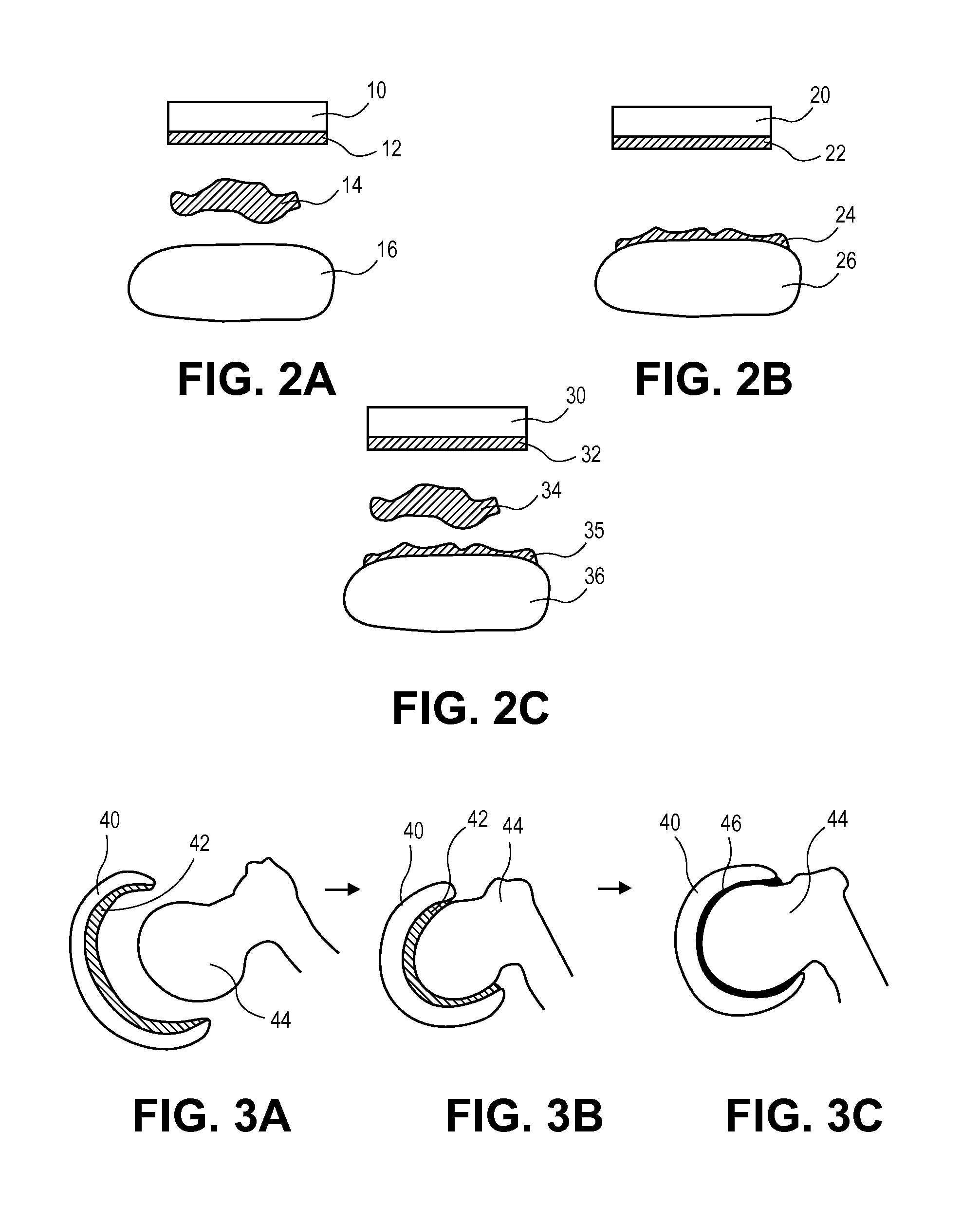 Methods, Devices and Compositions for Adhering Hydrated Polymer Implants to Bone