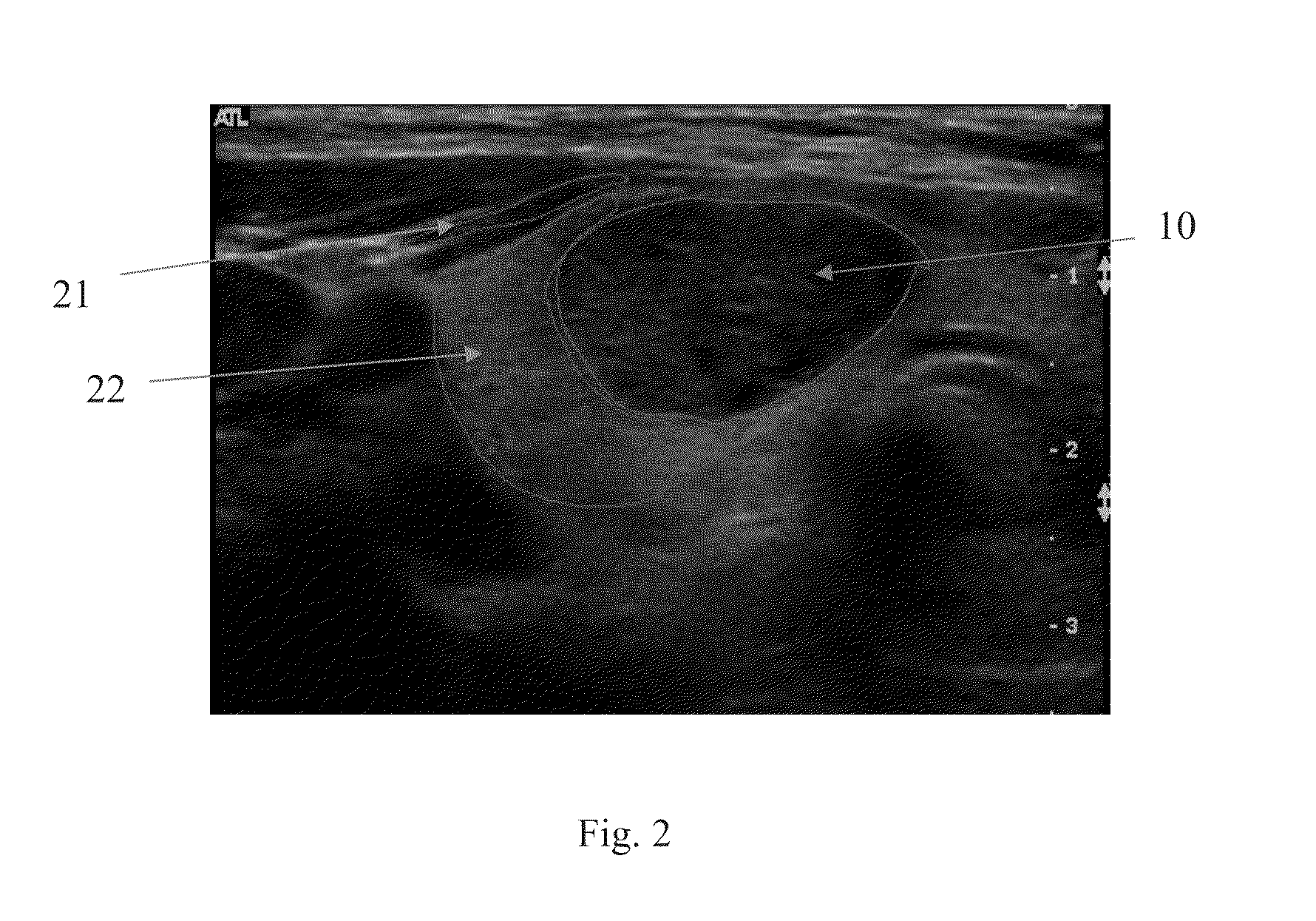 Echogenicity quantification method and calibration method for ultrasonic device using echogenicity index