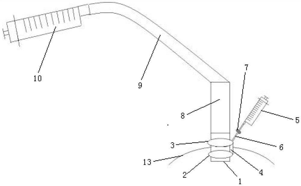 Subretinal fluid drainage device and collector