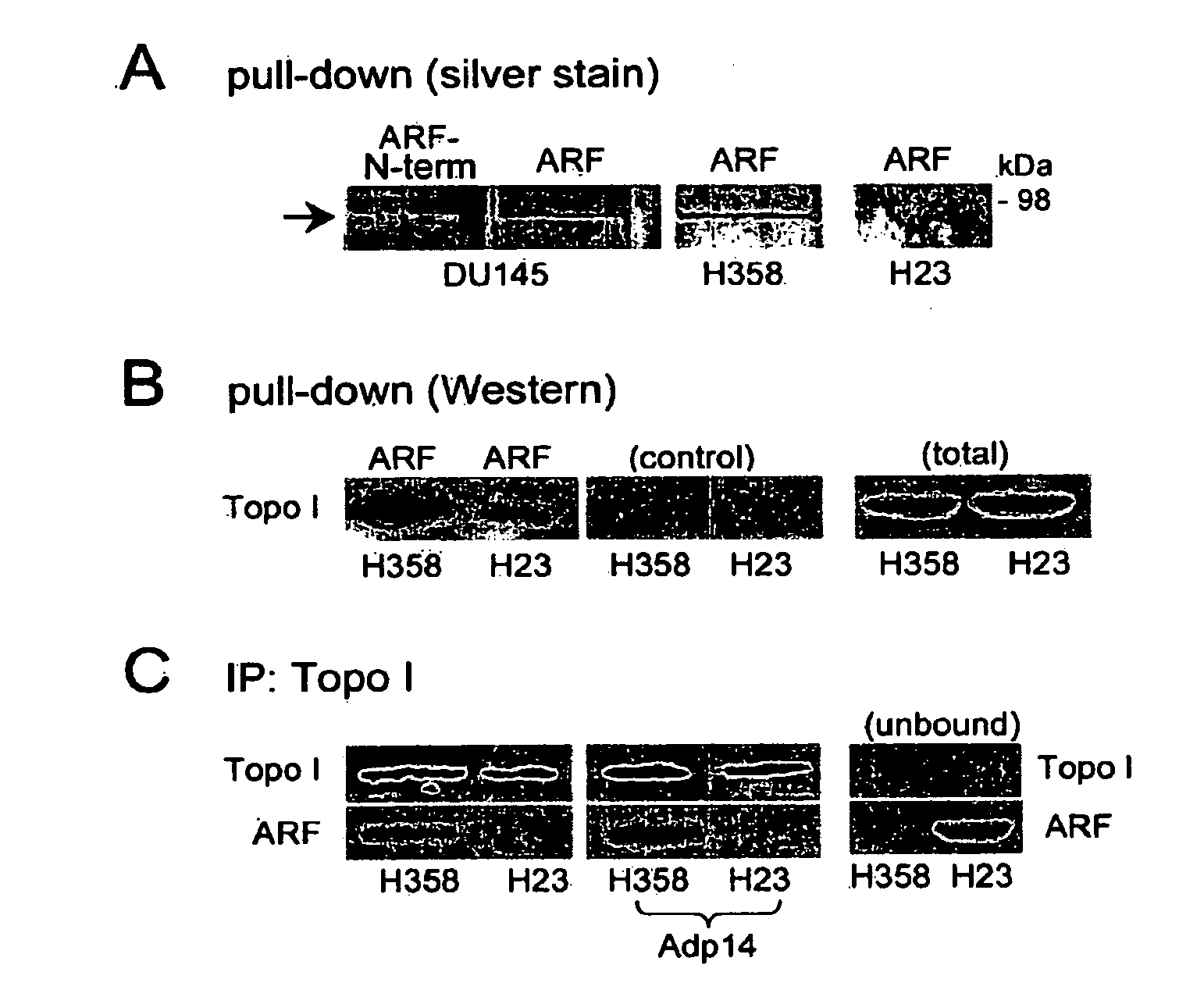 Methods and compositions for topoisomerase i modulated tumor suppression