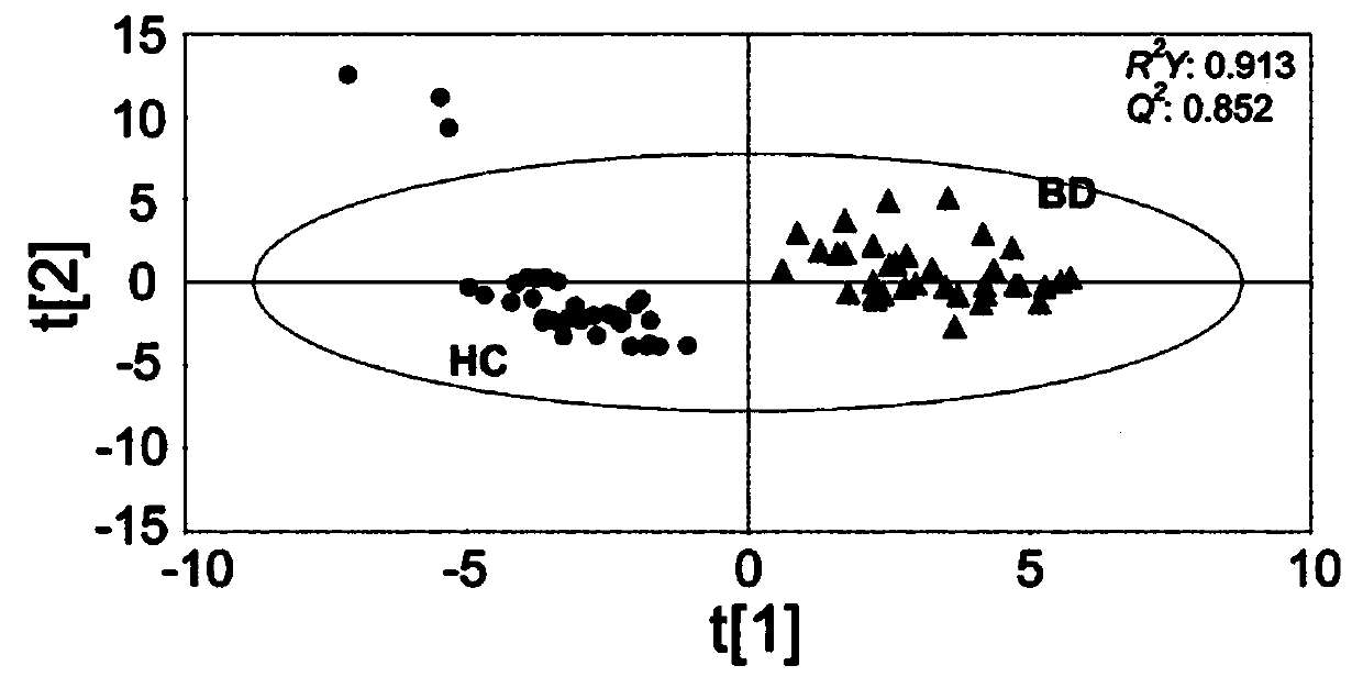 Diagnostic method for behcet's disease using metabolome analysis