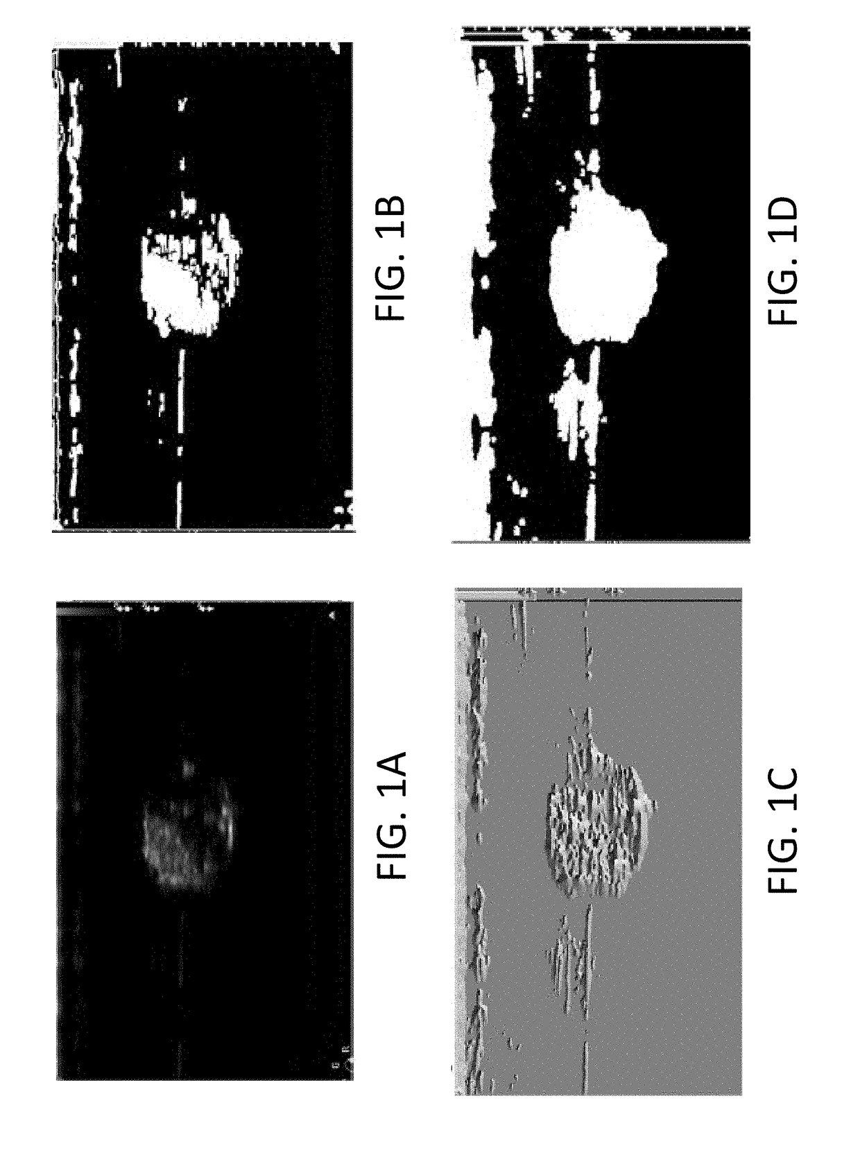 Systems and methods for automated image recognition of implants and compositions with long-lasting echogenicity