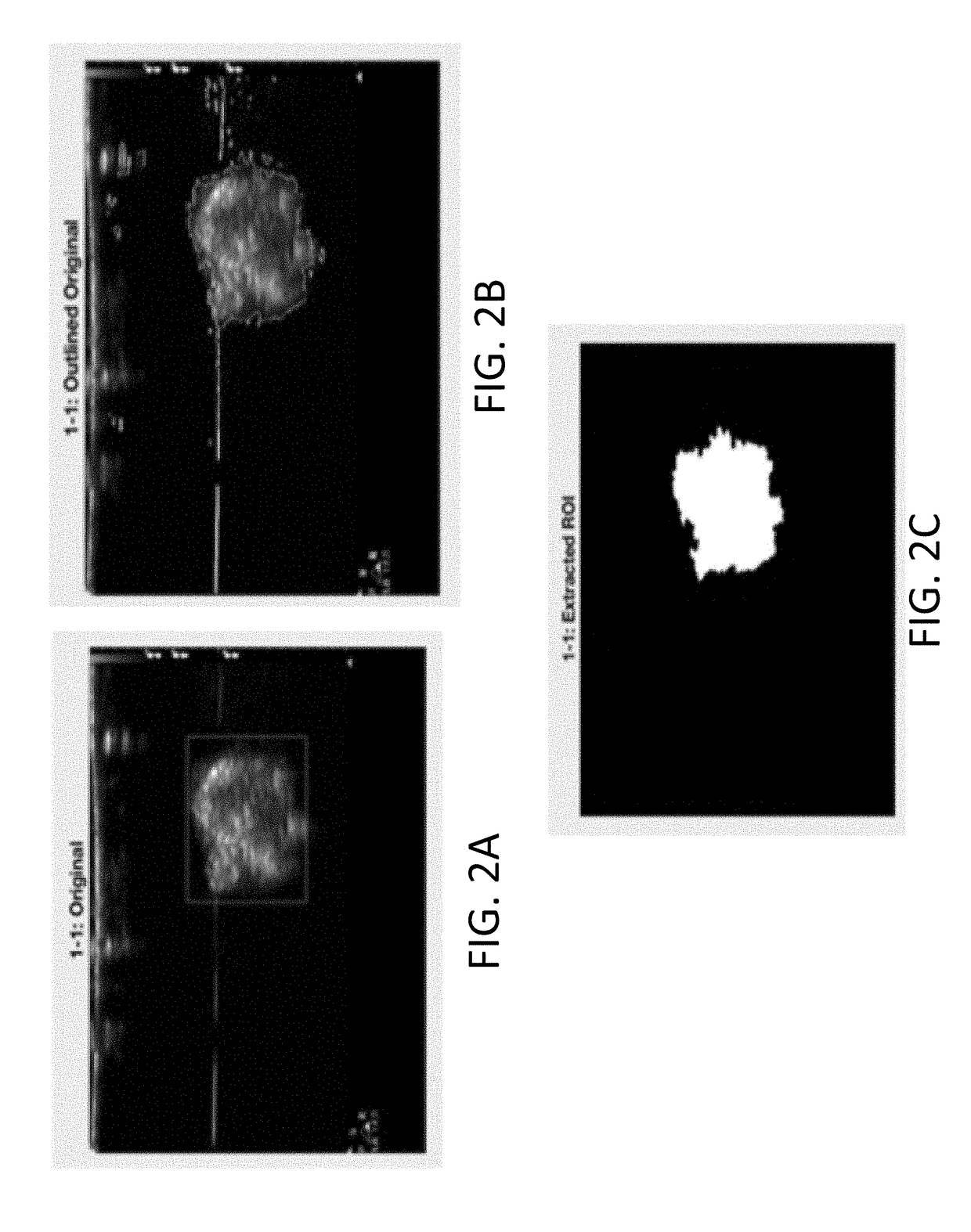 Systems and methods for automated image recognition of implants and compositions with long-lasting echogenicity