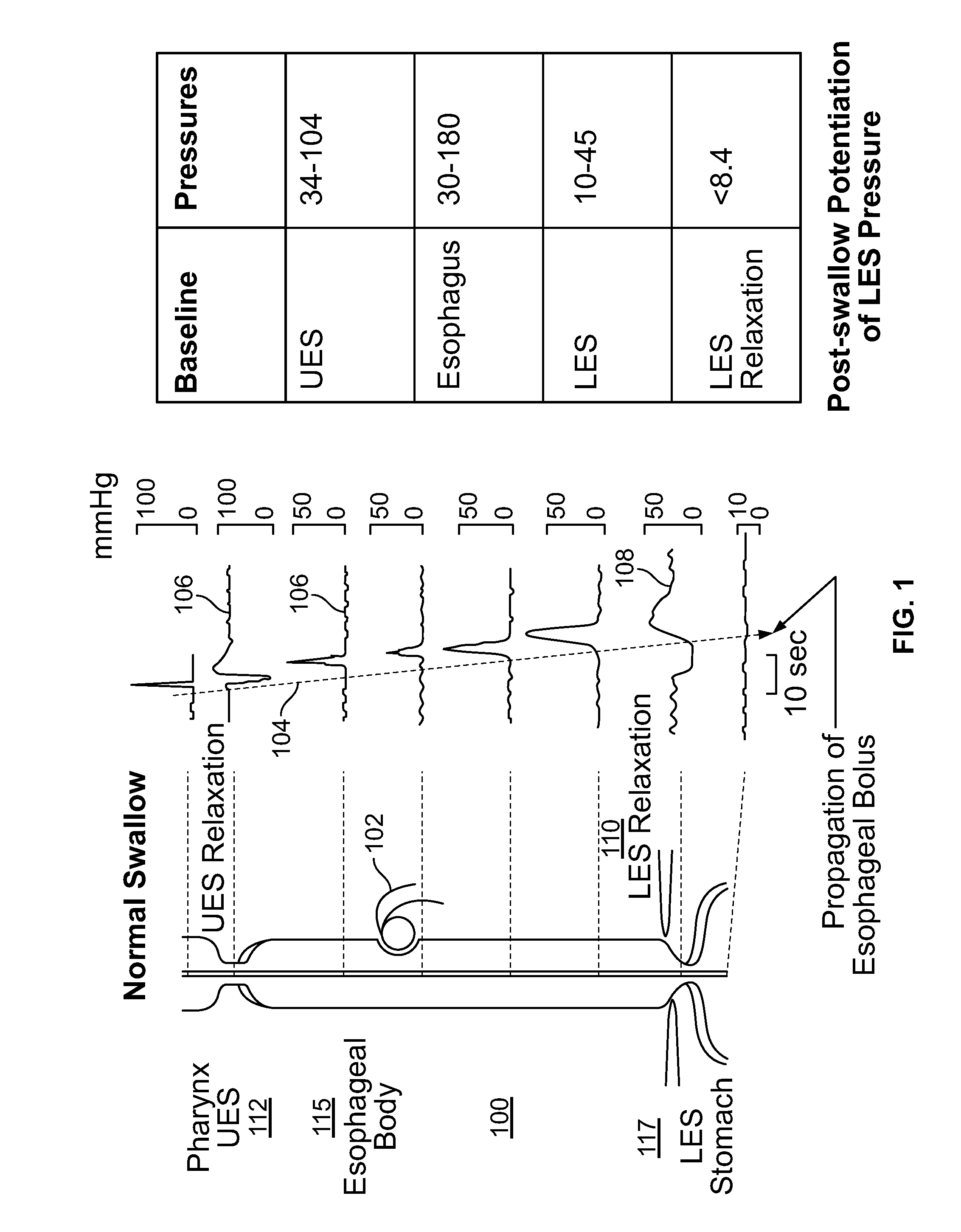 Device and Implantation System for Electrical Stimulation of Biological Systems