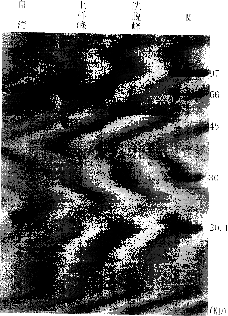 Purification process and application of antigen capable of being used in diagnosis of multiple myitis/dermatomyositis