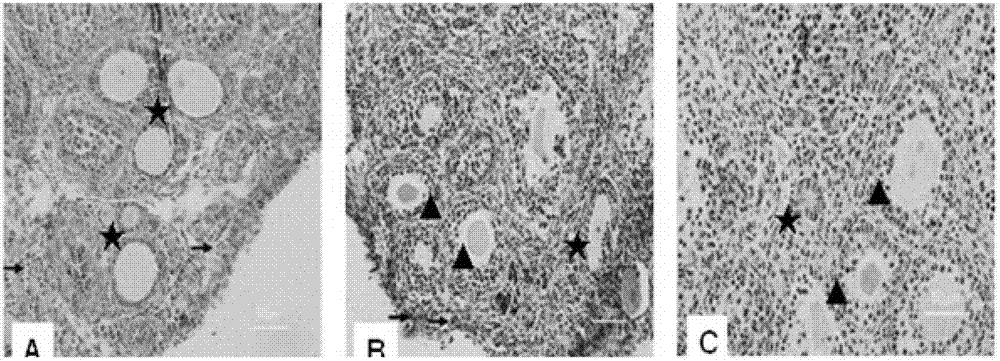 Ovarian large cortex piece vitrified cryopreservation protection liquid and cryopreservation method thereof