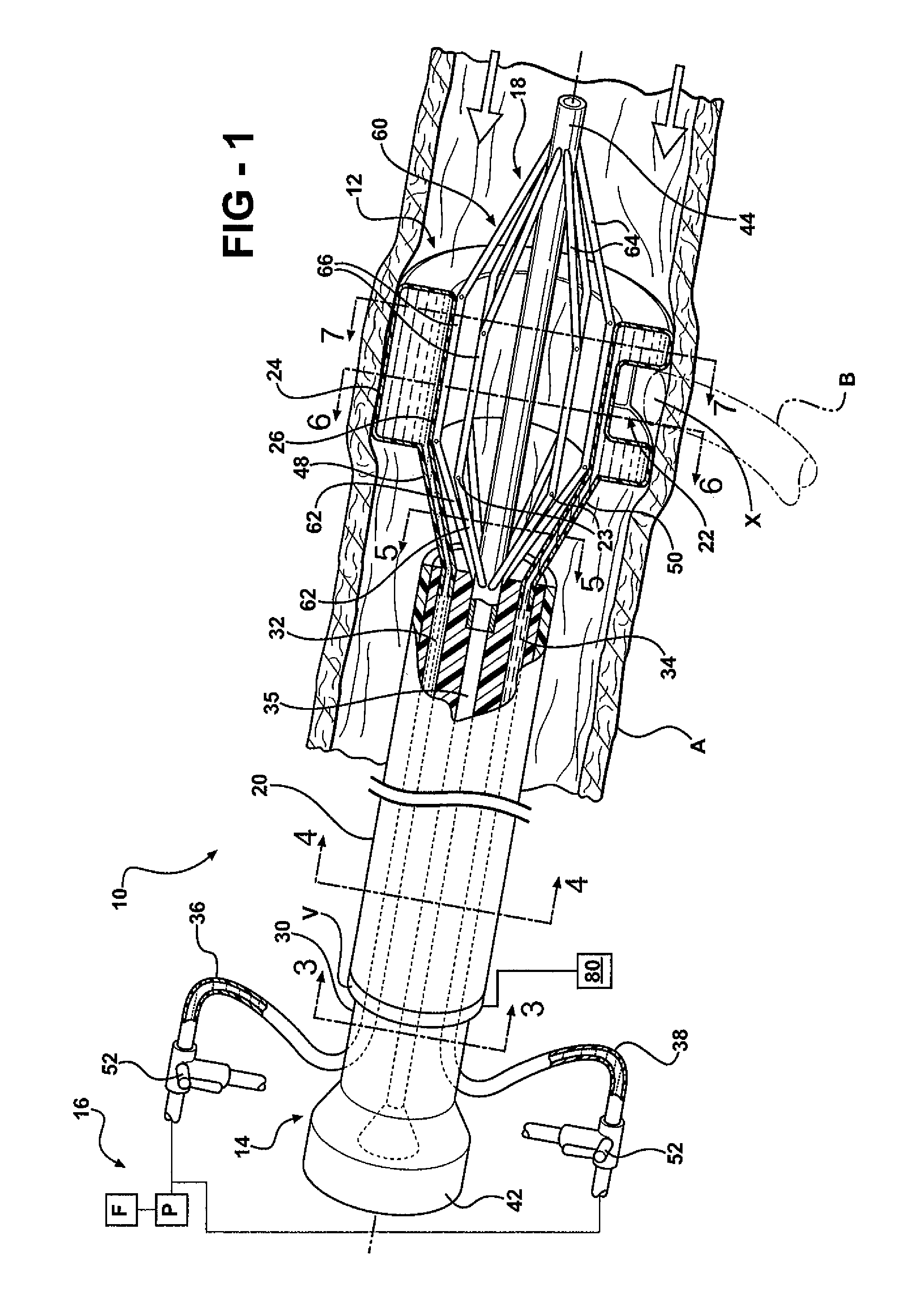 Clampless anastomotic device