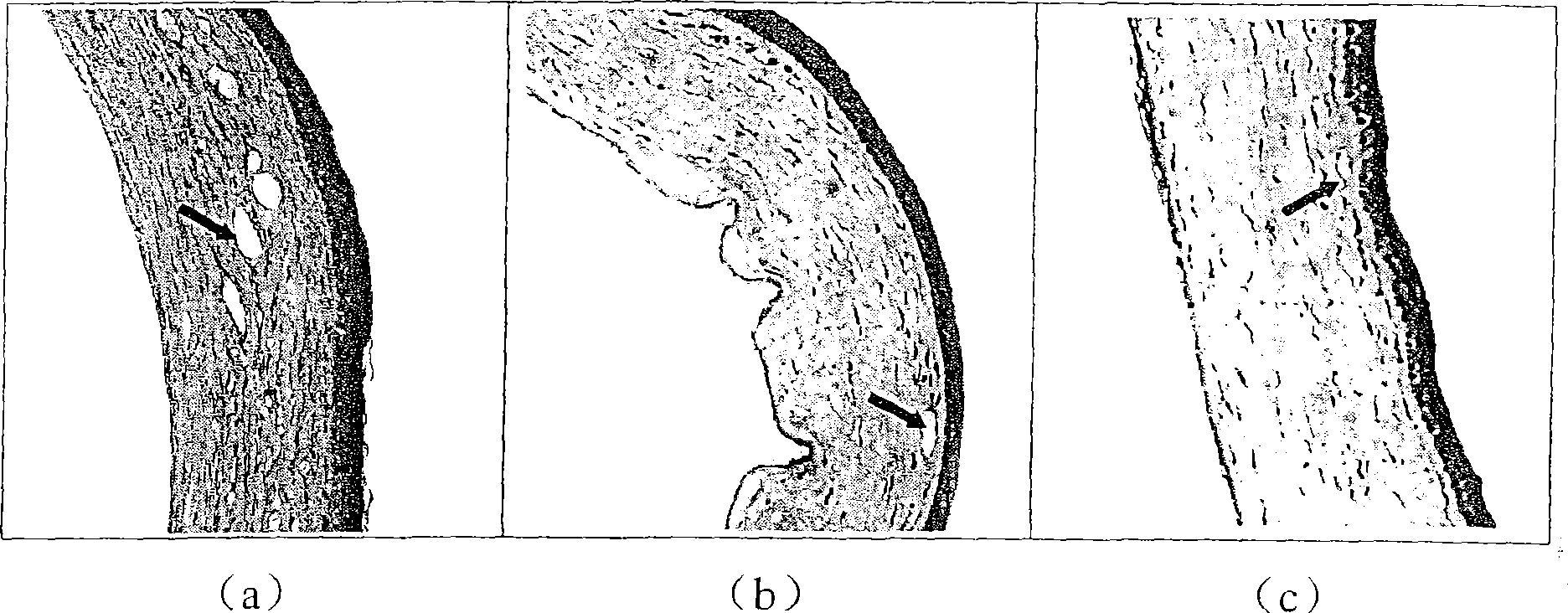 Production of amniotic extractive liquid and use thereof