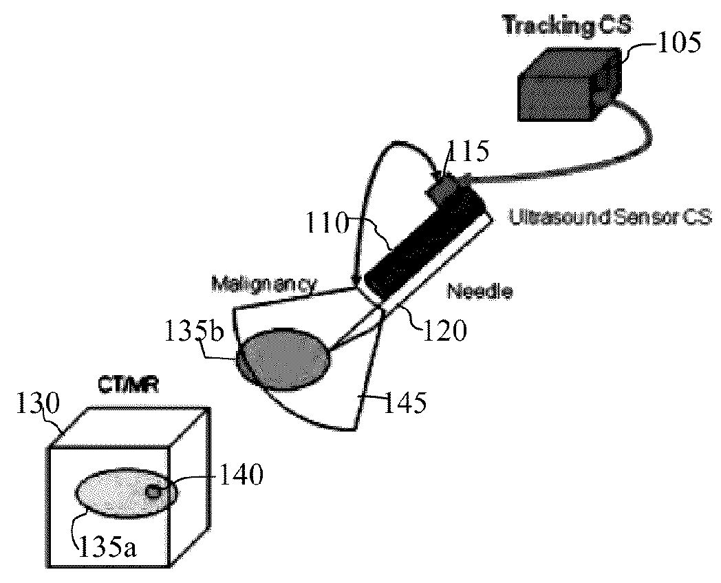 System and method for real-time ultrasound guided prostate needle biopsy based on biomechanical model of the prostate from magnetic resonance imaging data