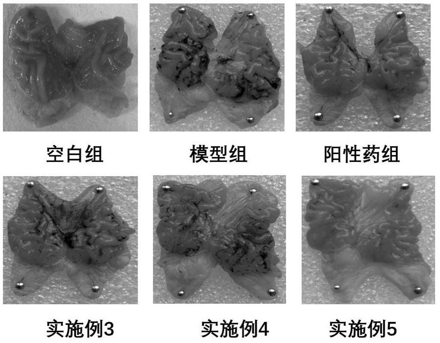 Chenopodium quinoa willd extract and application thereof in preparation of medicine and food for preventing gastric mucosal lesion