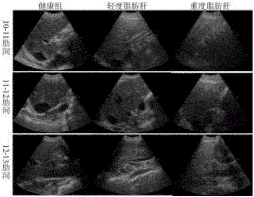 Application of ultrasonic detection equipment in semiquantitatively determining sheep fatty liver