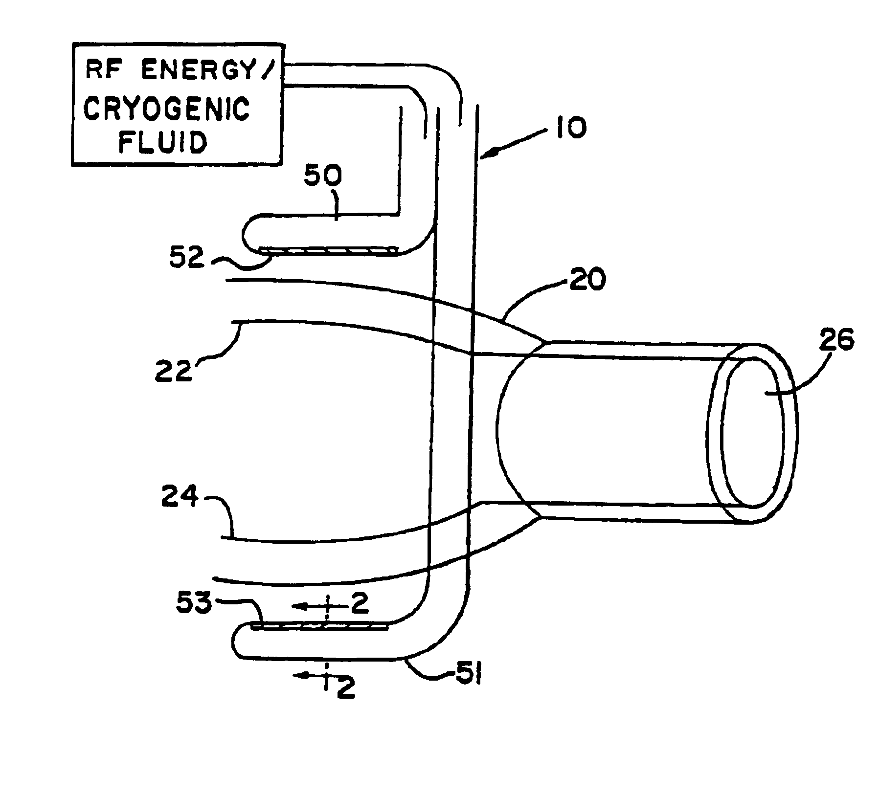 Transmural ablation device with integral EKG sensor