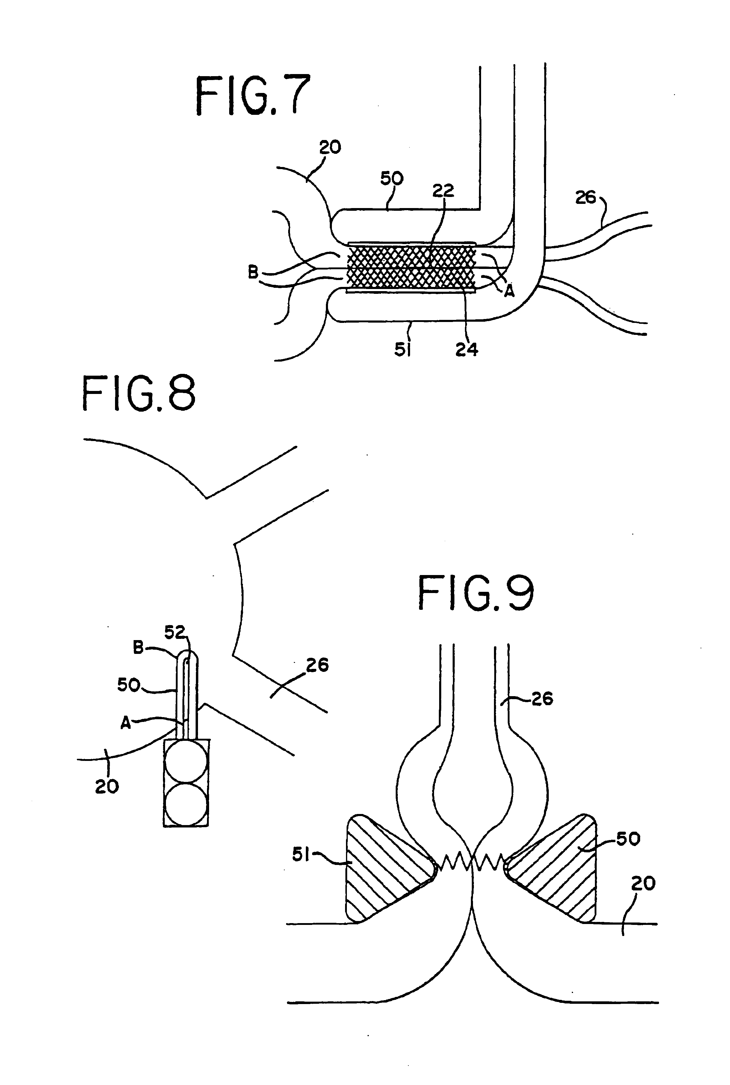 Transmural ablation device with integral EKG sensor