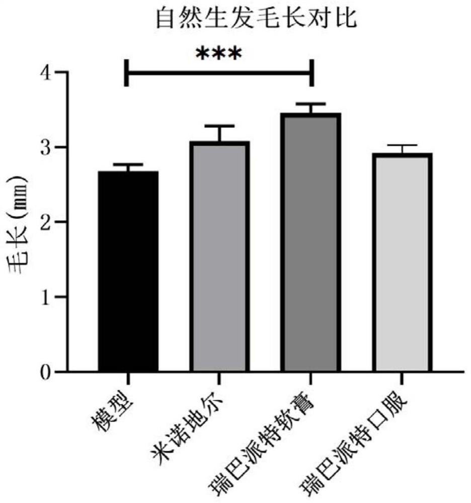 Anti-hair loss and hair growth uses of rebamipide