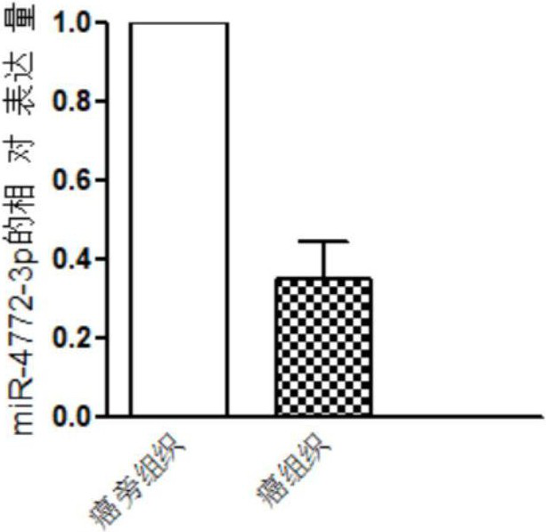 miRNAs for the diagnosis and treatment of hepatocellular carcinoma