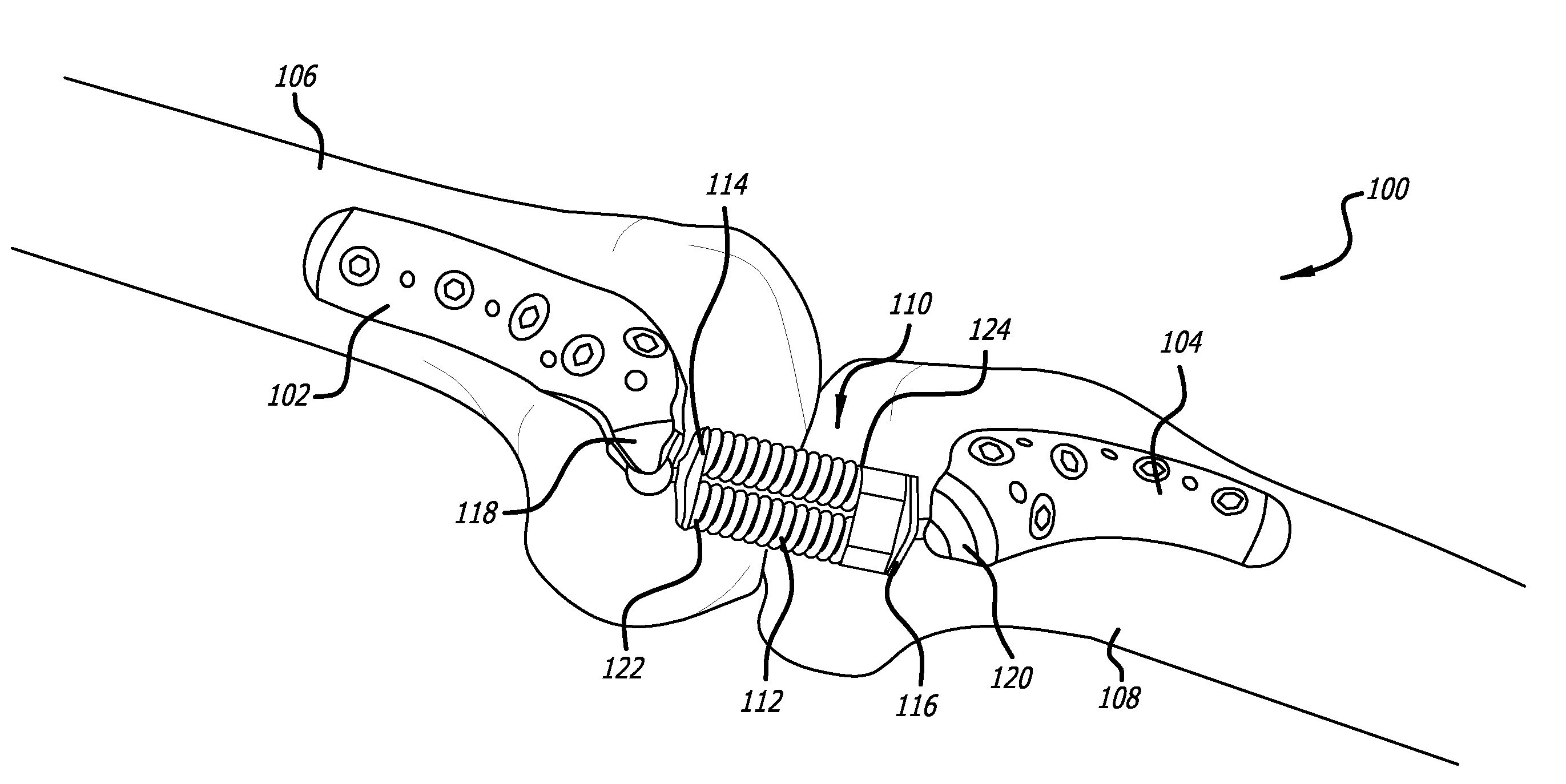 Adjustable absorber designs for implantable device