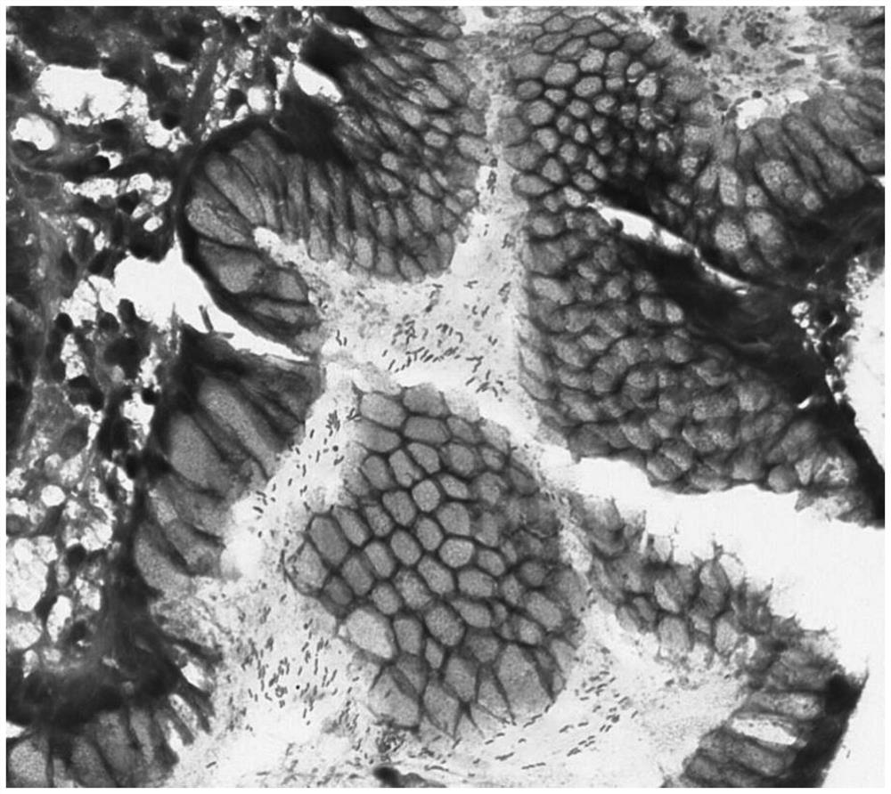 A kind of Helicobacter pylori staining liquid and staining method thereof