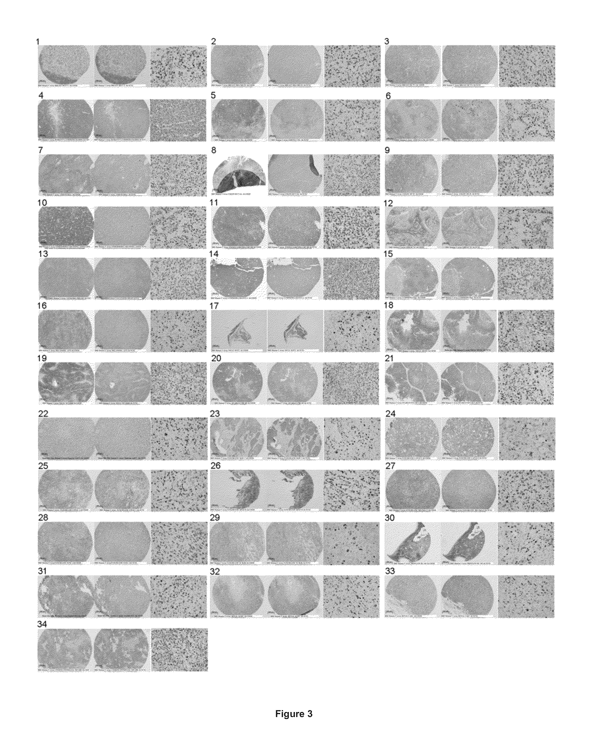 Methods for the diagnosis, treatment and monitoring of cancer