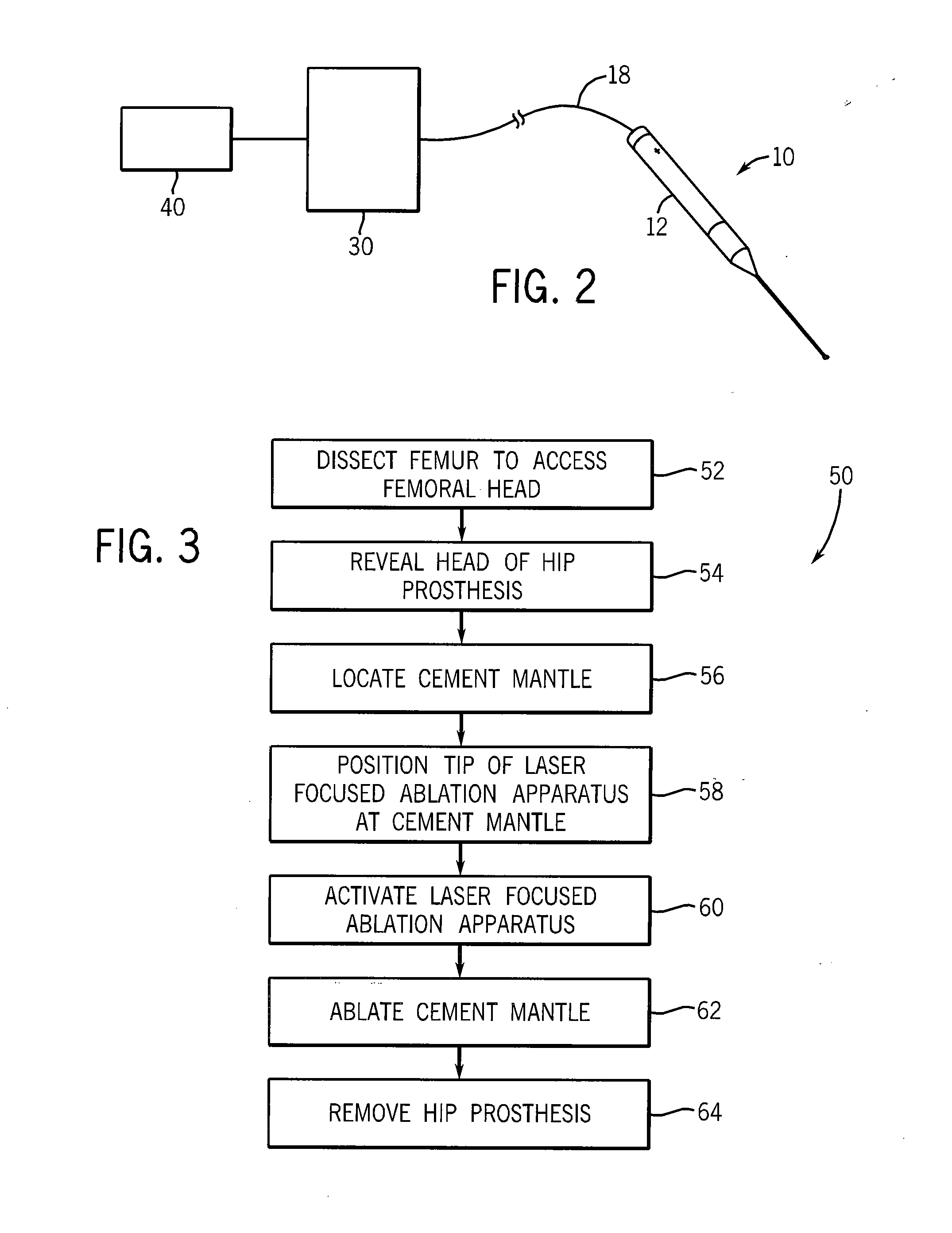 Laser Focused Ablation Apparatus and Method of Use in Revision Arthroplasty