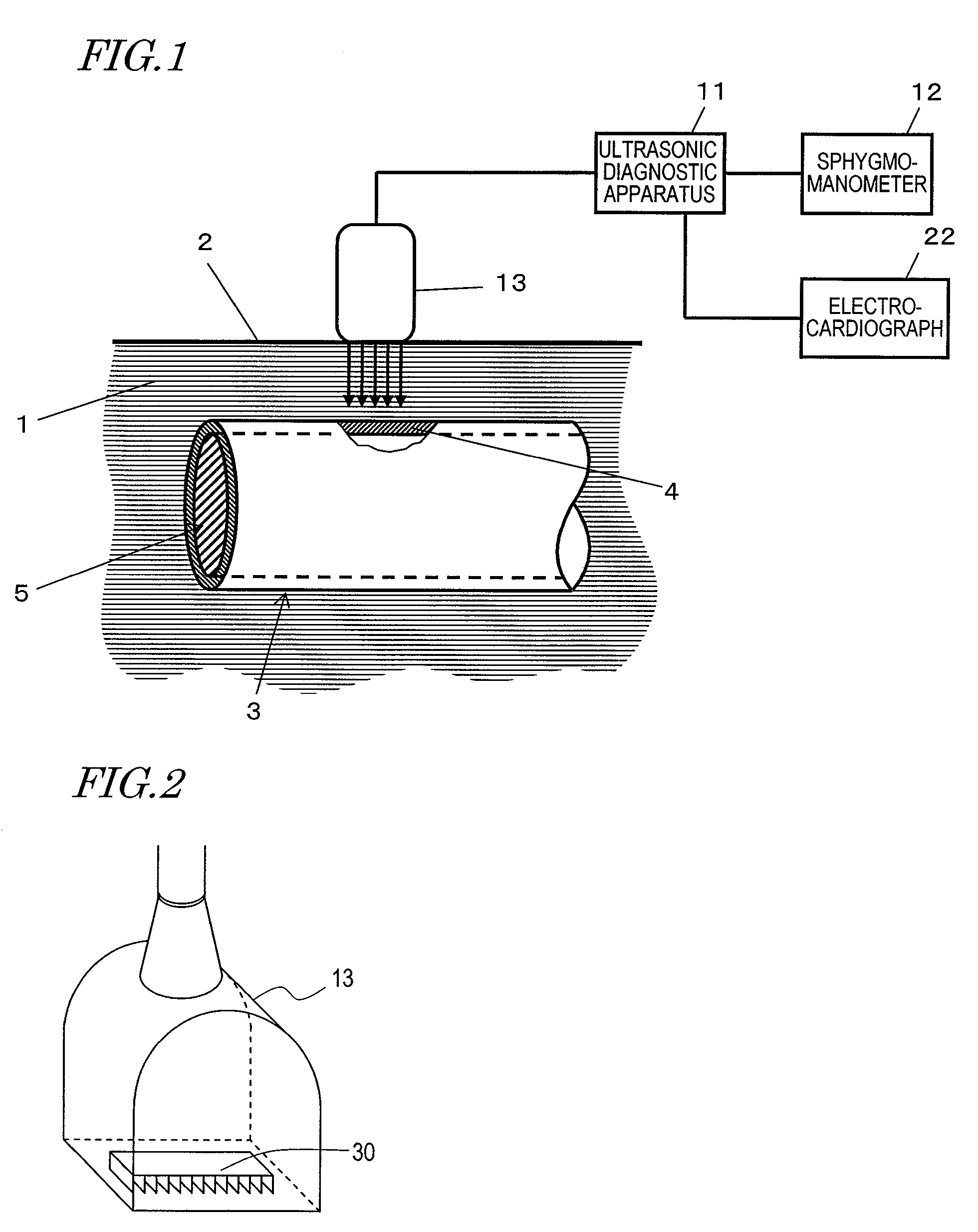 Ultrasonic diagnosis device and ultrasonic probe for use in ultrasonic diagnosis device