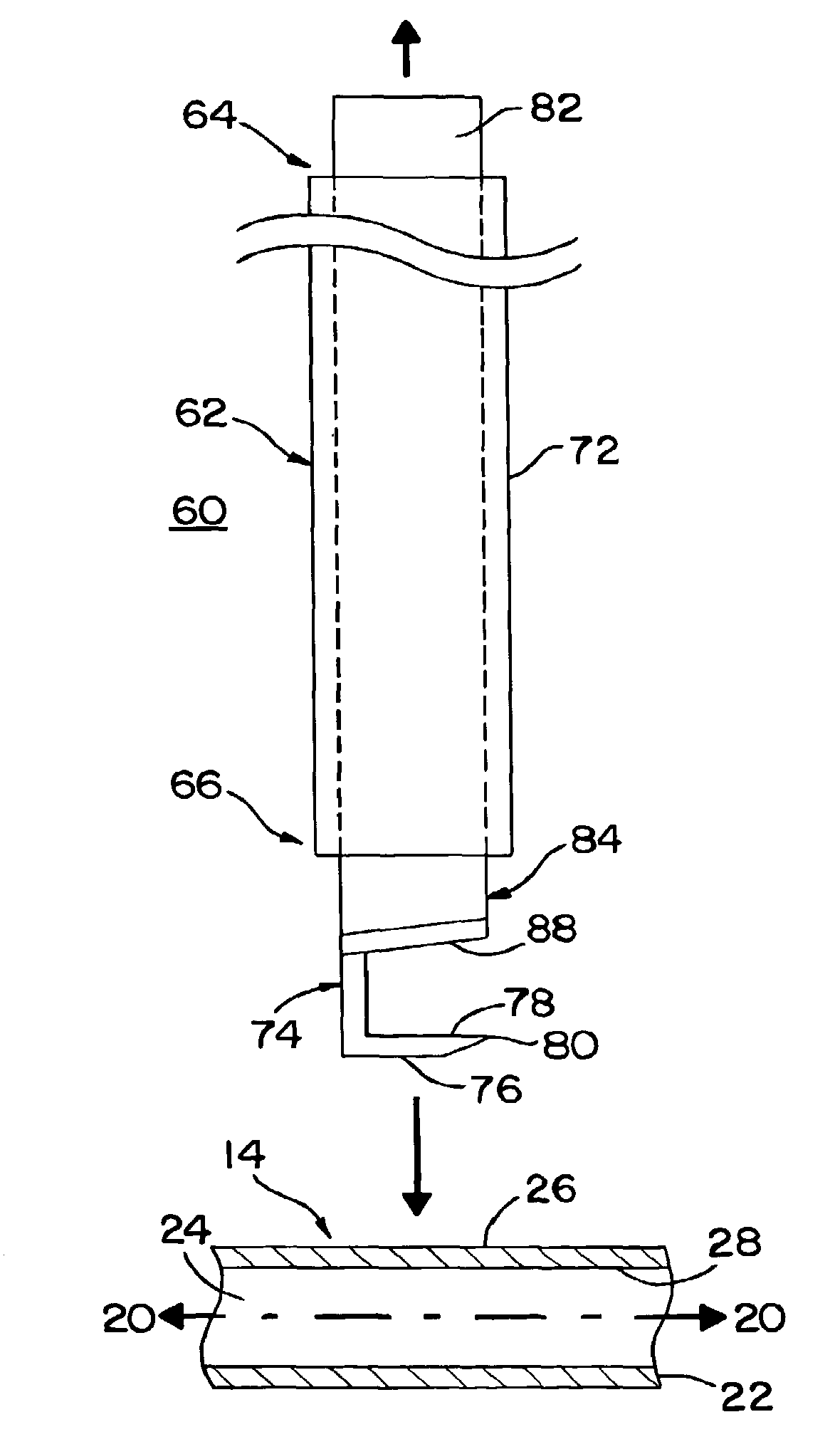 Methods and apparatus for making precise incisions in body vessels