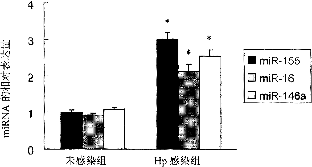 Application of miR-155 in preparing medicine for curing gastricism