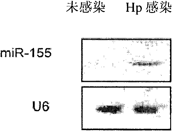 Application of miR-155 in preparing medicine for curing gastricism