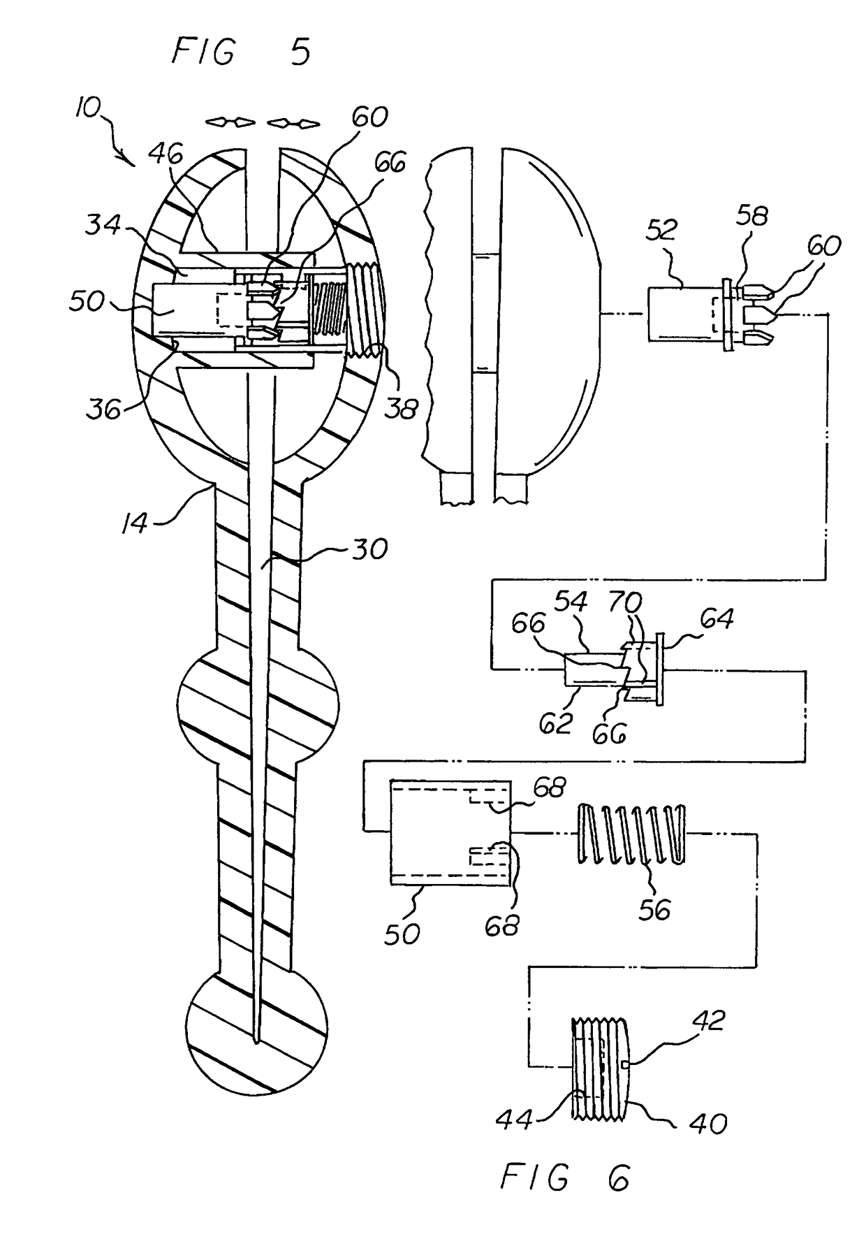 Incontinency abatement system